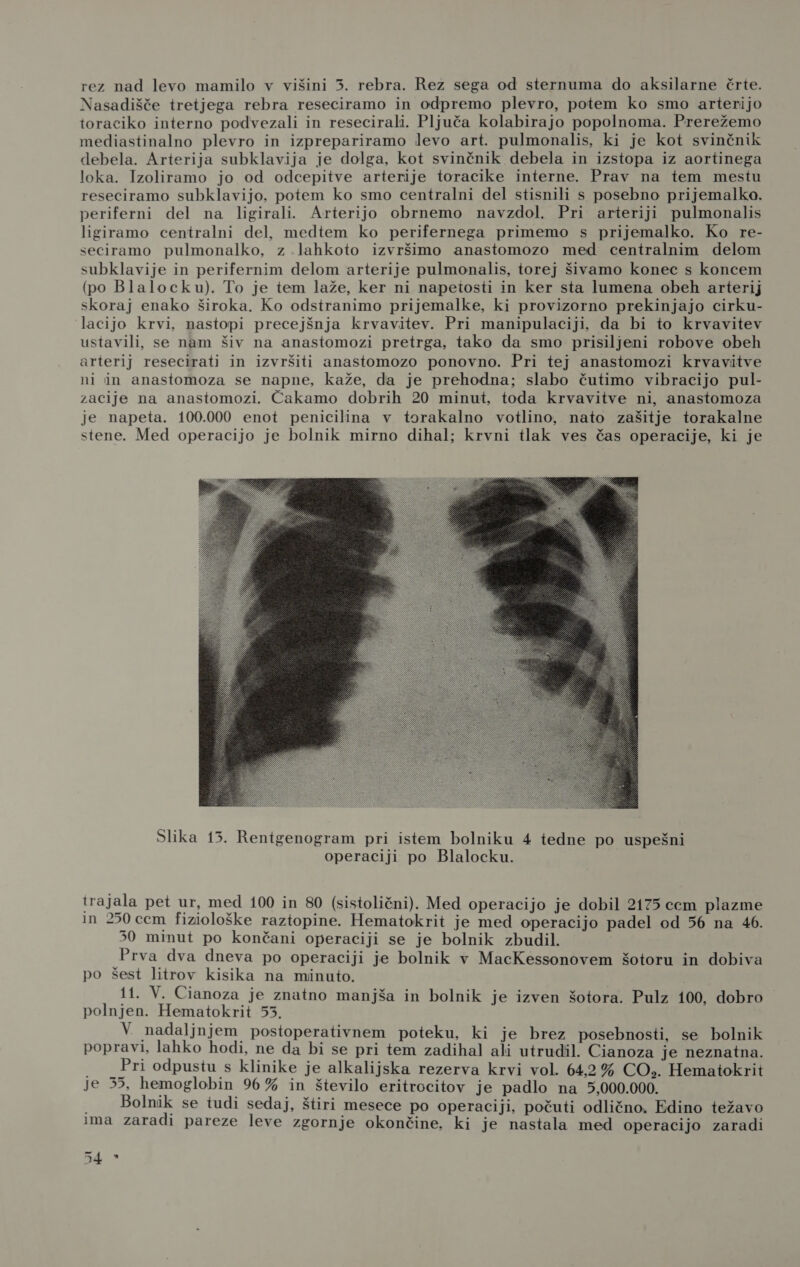 rez nad levo mamilo v višini 5. rebra. Rez sega od sternuma do aksilarne črte. Nasadišče tretjega rebra reseciramo in odpremo plevro, potem ko smo arterijo toraciko interno podvezali in resecirali. Pljuča kolabirajo popolnoma. Prerežemo mediastinalno plevro in izprepariramo levo art. pulmonalis, ki je kot svinčnik debela. Arterija subklavija je dolga, kot svinčnik debela in izstopa iz aortinega loka. Izoliramo jo od odcepitve arterije toracike interne. Prav na tem mestu reseciramo subklavijo, potem ko smo centralni del stisnili s posebno prijemalko. periferni del na ligirali. Arterijo obrnemo navzdol. Pri arteriji pulmonalis ligiramo centralni del, medtem ko perifernega primemo s prijemalko. Ko re- seciramo pulmonalko, z .lahkoto izvršimo anastomozo med centralnim delom subklavije in perifernim delom arterije pulmonalis, torej šivamo konec s koncem (po Blalocku). To je tem laže, ker ni napetosti in ker sta lumena obeh arterij skoraj enako široka. Ko odstranimo prijemalke, ki provizorno prekinjajo cirku- lacijo krvi, nastopi precejšnja krvavitev. Pri manipulaciji, da bi to krvavitev ustavili, se nam šiv na anastomozi pretrga, tako da smo prisiljeni robove obeh arterij resecirati in izvršiti anastomozo ponovno. Pri tej anastomozi krvavitve ni in anastomoza se napne, kaže, da je prehodna; slabo čutimo vibracijo pul- zacije na anastomozi. Čakamo dobrih 20 minut, toda krvavitve ni, anastomoza je napeta. 100.000 enot penicilina v torakalno votlino, nato zašitje torakalne stene. Med operacijo je bolnik mirno dihal; krvni tlak ves čas operacije, ki je Slika 13. Rentgenogram pri istem bolniku 4 tedne po uspešni operaciji po Blalocku. trajala pet ur, med 100 in 80 (sistolični). Med operacijo je dobil 2175 cem plazme in 250 cem fiziološke raztopine. Hematokrit je med operacijo padel od 56 na 46. 50 minut po končani operaciji se je bolnik zbudil. Prva dva dneva po operaciji je bolnik v MacKessonovem šotoru in dobiva po šest litrov kisika na minuto. 14. V. Cianoza je znatno manjša in bolnik je izven šotora. Pulz 100, dobro polnjen. Hematokrit 55. V nadaljnjem postoperativnem poteku, ki je brez posebnosti, se bolnik popravi, lahko hodi, ne da bi se pri tem zadihal ali utrudil. Cianoza je neznatna. Pri odpustu s klinike je alkalijska rezerva krvi vol. 64,2 % CO». Hematokrit je 35, hemoglobin 96 % in število eritrocitov je padlo na 5,000.000. . Bolnik se tudi sedaj, štiri mesece po operaciji, počuti odlično. Edino težavo ima zaradi pareze leve zgornje okončine, ki je nastala med operacijo zaradi