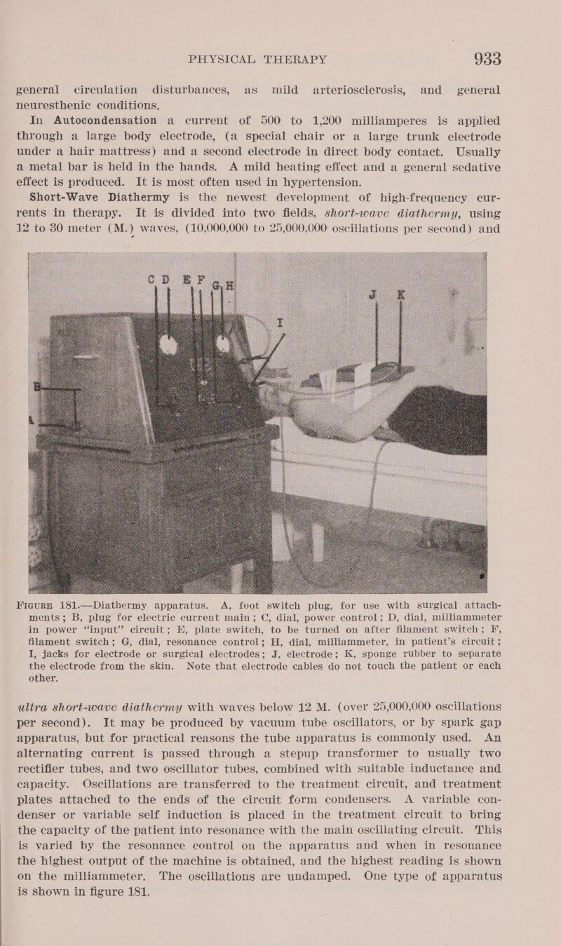 general circulation disturbances, as mild arteriosclerosis, and general neuresthenic conditions, In Autocondensation a current of 500 to 1,200 milliamperes is applied through a large body electrode, (a special chair or a large trunk electrode under a hair mattress) and a second electrode in direct body contact. Usually a metal bar is held in the hands. A mild heating effect and a general sedative effect is produced. It is most often used in hypertension. Short-Wave Diathermy is the newest development of high-frequency cur- rents in therapy. It is divided into two fields, short-wave diathermy, using 12 to 80 meter (M.) waves, (10,000,000 to 25,000,000 oscillations per second) and Figurp 181.—Diathermy apparatus. A, foot switch plug, for use with surgical attach- ments; B, plug for electric current main; C, dial, power control; D, dial, milliammeter in power “input” circuit; EH, plate switch, to be turned on after filament switch; F, filament switch; G, dial, resonance control; H, dial, milliammeter, in patient’s circuit ; I, jacks for electrode or surgical electrodes; J, electrode; K, sponge rubber to separate the electrode from the skin. Note that electrode cables do not touch the patient or each other. ultra short-wave diathermy with waves below 12 M. (over 25,000,000 oscillations per second). It may be produced by vacuum tube oscillators, or by spark gap apparatus, but for practical reasons the tube apparatus is commonly used. An alternating current is passed through a stepup transformer to usually two rectifier tubes, and two oscillator tubes, combined with suitable inductance and capacity. Oscillations are transferred to the treatment circuit, and treatment plates attached to the ends of the circuit form condensers. A variable con- denser or variable self induction is placed in the treatment circuit to bring the capacity of the patient into resonance with the main oscillating circuit. This is varied by the resonance control on the apparatus and when in resonance the highest output of the machine is obtained, and the highest reading is shown on the milliammeter. The oscillations are undamped. One type of apparatus is shown in figure 181.
