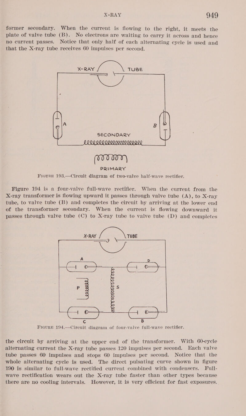 former secondary. When the current is flowing to the right, it meets the plate of valve tube (B). No electrons are waiting to carry it across and hence no current passes. Notice that only half of each alternating cycle is used and that the X-ray tube receives 60 impulses per second.  PRIMARY FicurRn 193.—Circuit diagram of two-valve half-wave rectifier. Figure 194 is a four-valve full-wave rectifier. When the current from the X-ray transformer is flowing upward it passes through valve tube (A), to X-ray tube, to valve tube (B) and completes the circuit by arriving at the lower end of the transformer secondary. When the current is flowing downward it passes through valve tube (C) to X-ray tube to valve tube (D) and completes X-RAY a: ees A D P 3° ee omen a Cc B Figure 194.—Circuit diagram of four-valve full-wave rectifier. the circuit by arriving at the upper end of the transformer. With 60-cycle alternating current the X-ray tube passes 120 impulses per second. Hach valve tube passes 60 impulses and stops 60 impulses per second. Notice that the whole alternating cycle is used. The direct pulsating curve shown in figure 190 is similar to full-wave rectified current combined with condensers. Full- wave rectification wears out the X-ray tube faster than other types because there are no cooling intervals. However, it is very efficient for fast exposures.