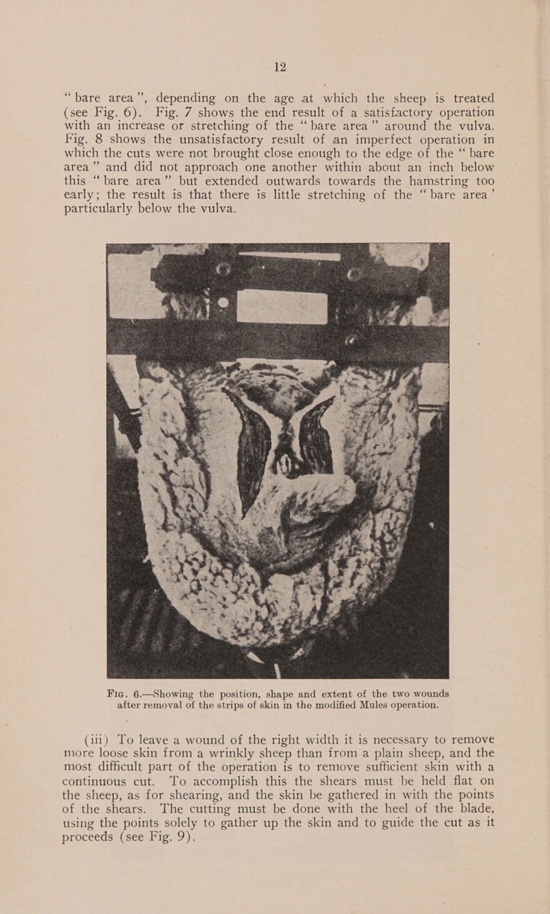 “bare area”’, depending on the age at which the sheep is treated (see Fig. 6). Fig. 7 shows the end result of a satisfactory operation with an increase or stretching of the “bare area” around the vulva. fig. 8 shows the unsatisfactory result of an imperfect operation in which the cuts were not brought close enough to the edge of the “ bare area’ and did not approach one another within about an inch below this “bare area” but extended outwards towards the hamstring too early; the result is that there is little stretching of the “bare area’ particularly below the vulva. Fig. 6.—Showing the position, shape and extent of the two wounds after removal of the strips of skin in the modified Mules operation. (iu) To leave a wound of the right width it is necessary to remove more loose skin from a wrinkly sheep than from a plain sheep, and the most difficult part of the operation is to remove sufficient skin with a continuous cut. To accomplish this the shears must be held flat on the sheep, as for shearing, and the skin be gathered in with the points of the shears. The cutting must be done with the heel of the blade, using the points solely to gather up the skin and to guide the cut as it proceeds’ (see Hie, 9).
