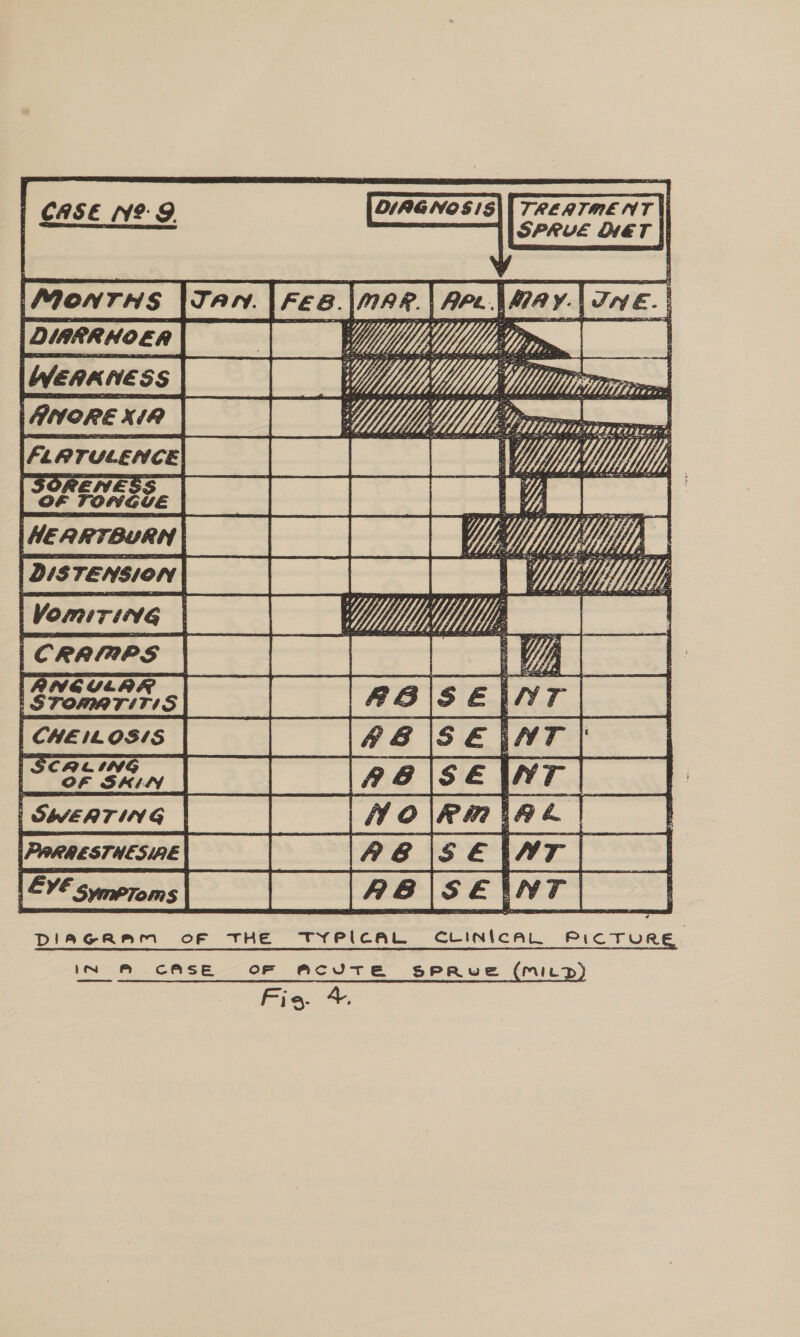  OIAGNOS1IS\| TREATMENT \i Ieee Jan. |Fee.|mar.| Are.\May.| Jove. | Ze ey De mi: rm -— moeee| —1 Ve a UMN pes recrgee t———|-— |---| ~—- -} fecrracen| ||| AD = 33s YM, Ee Mewes | wale] ae fees ties eee) Pareia| [lease | wrt} Swearing |__| || Wolemiag | | Evésmeroms| | |Ra|selwT| | DIAGRAM oF THE TYPICAL CLINICAL peer ee , IN M CASE OF ACUTE SPRVLE (MILD) Fig. +.     5                              i ail &lt; ~    
