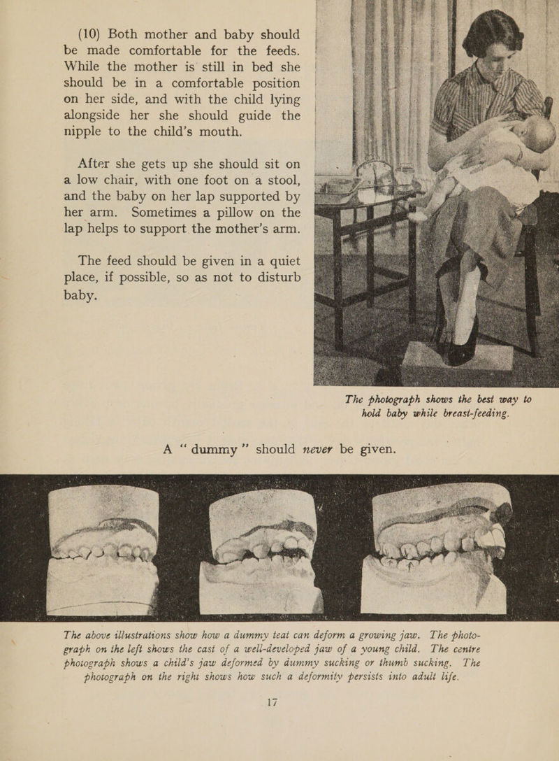 (10) Both mother and baby should be made comfortable for the feeds. While the mother is still in bed she should be in a comfortable position on her side, and with the child lying alongside her she should guide the nipple to the child’s mouth. After she gets up she should sit on a low chair, with one foot on a stool, and the baby on her lap supported by her arm. Sometimes a pillow on the lap helps to support.the mother’s arm. The feed should be given in a quiet place, if possible, so as not to disturb baby.  The photograph shows the best way to hold baby while breast-feeding. 9 A “dummy ” should never be given. 