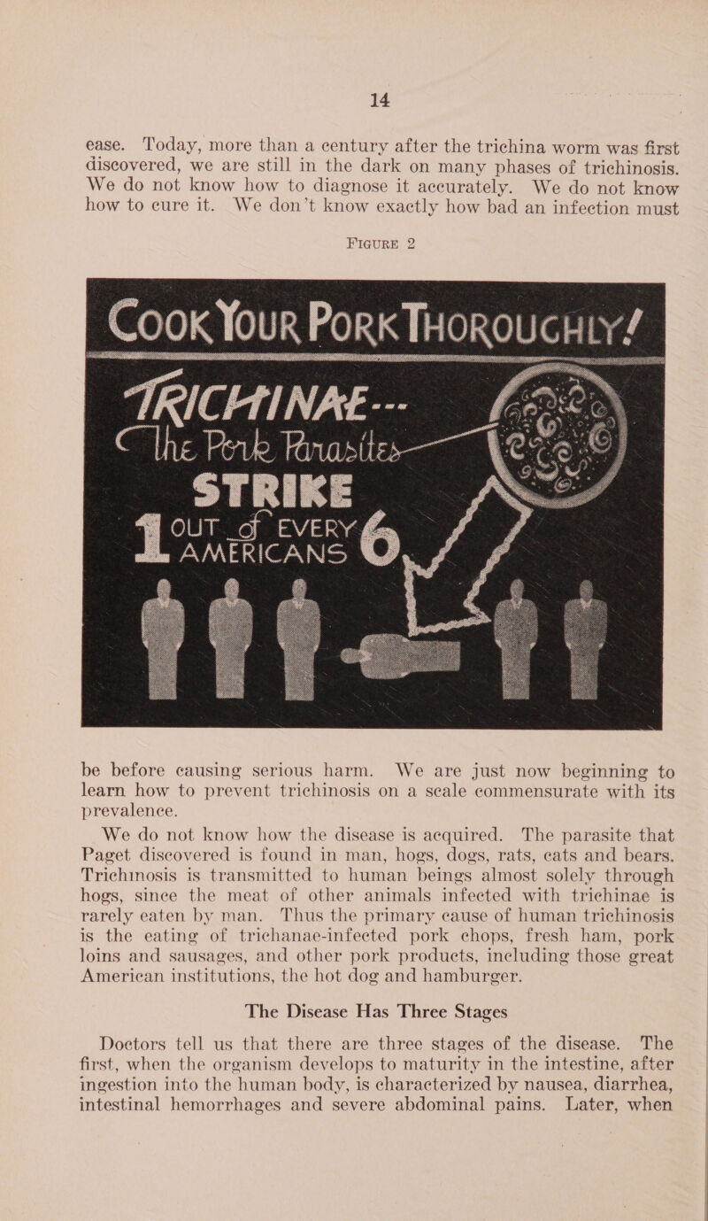 ease. Today, more than a century after the trichina worm was first discovered, we are still in the dark on many phases of trichinosis. We do not know how to diagnose it accurately. We do not know how to cure it. We don’t know exactly how bad an infection must FIGURE 2 OUT _of EVERY PRINT AGN Ns  be before causing serious harm. We are just now beginning to learn how to prevent trichinosis on a seale commensurate with its prevalence. We do not know how the disease is acquired. The parasite that Paget discovered is found in man, hogs, dogs, rats, eats and bears. Trichinosis is transmitted to human beings almost solely through hogs, since the meat of other animals infected with trichinae is rarely eaten by man. Thus the primary eause of human trichinosis is the eating of trichanae-infected pork chops, fresh ham, pork loins and sausages, and other pork products, including those great American institutions, the hot dog and hamburger. The Disease Has Three Stages Doctors tell us that there are three stages of the disease. The first, when the organism develops to maturity in the intestine, after ingestion into the human body, is characterized by nausea, diarrhea, intestinal hemorrhages and severe abdominal pains. Later, when