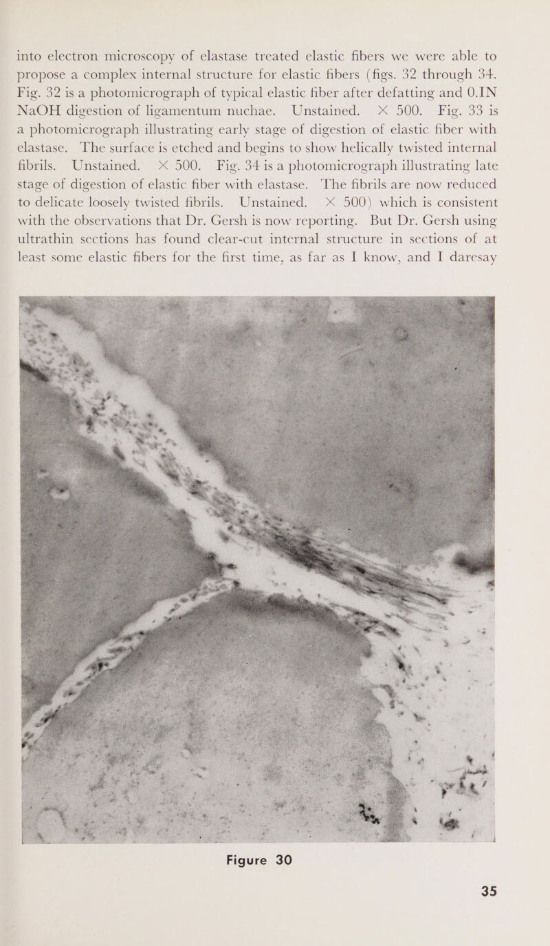 into electron microscopy of elastase treated elastic fibers we were able to propose a complex internal structure for elastic fibers (figs. 32 through 34. Fig. 32 is a photomicrograph of typical elastic fiber after defatting and 0.IN NaOH digestion of ligamentum nuchae. Unstained. X 500. Fig. 33 is a photomicrograph illustrating early stage of digestion of elastic fiber with elastase. The surface is etched and begins to show helically twisted internal fibrils. Unstained. 500. Fig. 34 1s a photomicrograph illustrating late stage of digestion of elastic fiber with elastase. The fibrils are now reduced to delicate loosely twisted fibrils. Unstained. X 500) which is consistent with the observations that Dr. Gersh is now reporting. But Dr. Gersh using ultrathin sections has found clear-cut internal structure in sections of at least some elastic fibers for the first time, as far as I know, and I daresay 