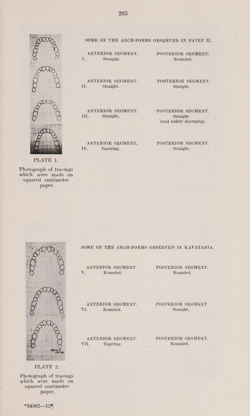 SOME OF THE ARCH-FORMS OBSERVED IN PATEP II, ANTERIOR SEGMENT. POSTERIOR SEGMENT. I. Straight. Rounded. ANTERIOR SEGMENT. POSTERIOR SEGMENT. didi Straight. Straight. ANTERIOR SEGMENT. POSTERION SEGMENT. Rite Straight. Straight (and widely diverging). ANTERIOR SEGMENT. POSTERIOR SEGMENT. IV. Tapering. Straight.  PLATE 1. Photograph of tracings which were made on Squared centimetre paper. SOME OF THE ARCH-FORMS OBSERVED IN KAVATARIA. ANTERIOR SEGMENT. POSTERIOR SEGMENT. Vie Rounded. Rounded. ANTERIOR SEGMENT. POSTERIOR SEGMENT Vale Rounded. Straight. ANTERIOR SEGMENT. POSTERIOR SEGMENT. VI. Tapering. ’ Rounded.  Photograph of tracings which were made on squared centimetre paper. *34562—129
