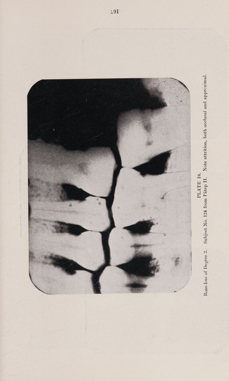 ‘jeunxoidde pur [esnjo00 440q “UOTITI498 940, e q 9oIHAQ] JO ssoT-ouog 