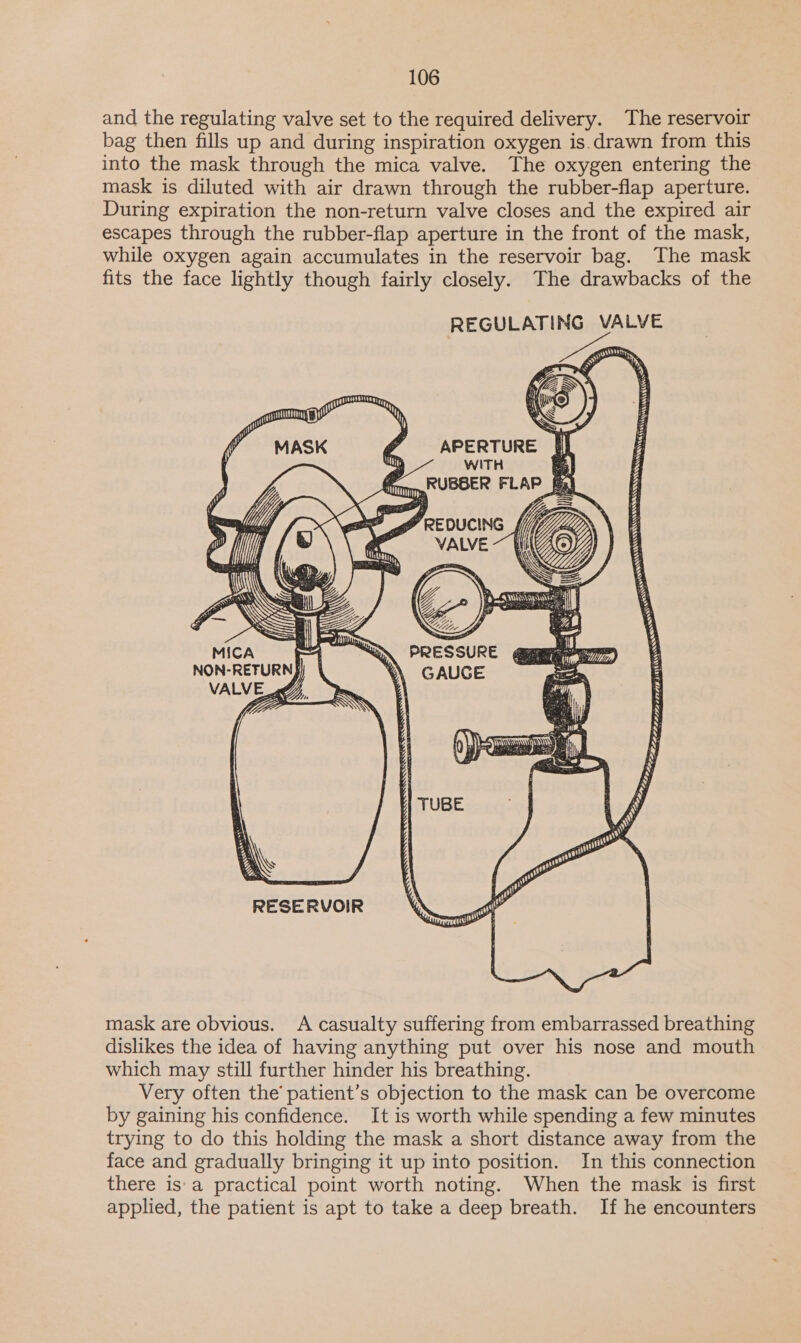 and the regulating valve set to the required delivery. The reservoir bag then fills up and during inspiration oxygen is.drawn from this into the mask through the mica valve. The oxygen entering the mask is diluted with air drawn through the rubber-flap aperture. During expiration the non-return valve closes and the expired air escapes through the rubber-flap aperture in the front of the mask, while oxygen again accumulates in the reservoir bag. The mask fits the face lightly though fairly closely. The drawbacks of the REGULATING VALVE pd der &gt; C &amp; y = i 1    APERTURE : Sitti, WITH A 4s» Atm, RUBEER AL DE A fj aK    SESS iAKER TEN ¥ il r aN : Sa ‘    apmertlite: NON-RETURN} GAUCE ~ eh VALVE _ ey Za nos    ie ||| TUBE RESERVOIR mask are obvious. A casualty suffering from embarrassed breathing dislikes the idea of having anything put over his nose and mouth which may still further hinder his breathing. Very often the’ patient’s objection to the mask can be overcome by gaining his confidence. It is worth while spending a few minutes trying to do this holding the mask a short distance away from the face and gradually bringing it up into position. In this connection there is'a practical point worth noting. When the mask is first applied, the patient is apt to take a deep breath. If he encounters