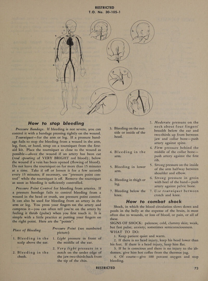  How to stop bleeding Pressure Bandage. \f bleeding is not severe, you can control it with a bandage pressing tightly on the wound. Tourniquet—for the arm or leg. If a pressure band- age fails to stop the bleeding from a wound in the arm, leg, foot, or hand, strap on a tourniquet from the first- aid kit. Place the tourniquet as close to the wound as possible—above the wound if an artery has been cut (real spouting of VERY BRIGHT red blood); below the wound if a vein has been opened (flowing of blood). Do not leave the tourniquet on for more than 15 minutes at a time. Take it off or loosen it for a few seconds every 15 minutes; if necessary, use “pressure point con- trol” while the tourniquet is off. Remove the tourniquet as soon as bleeding is sufficiently controlled. Pressure Point Control for bleeding from arteries. If a pressure bandage fails to control bleeding from a wound in the head or trunk, use pressure point control. It can also be used for bleeding from an artery in the arm or leg. You press your fingers on the artery and compress it—you can often tell you’re on the artery by feeling it throb (pulse) when you first touch it. It is simple with a little practice at putting your fingers on the right point. Here are the “points”: Pressure Point (see numbered Place of Bleeding sine re} I Bleeding inthe 1. scalp above the ear. Light pressure in front of the middle of the ear. 2. Very light pressure ina notch on the under edge of the jaw two-thirds back from the tip of the chin. 2. Bleeding in the cheek. eS) . Moderate pressure on the neck about four fingers’ breadth below the ear and two-thirds up from between jaw and collar bone—push aftery against spine. 3. Bleeding on the out- side or inside of the head. 4, Firm pressure behind the middle of the collar bone— push artery against the first rib. 5. Strong pressure on the inside of the arm halfway between shoulder and elbow. 4. Bleeding in the arm. 5. Bleeding in lower arm. 6. Strong pressure in groin 6. Bleeding in thigh or with heel of the hand—push leg. artery against pelvic bone. 7. Bleeding below the 7. Use tourniquet between knee. crotch and knee. How to combat shock Shock, in which the blood circulation slows down and pools in the belly at the expense of the brain, is most often due to wounds, or loss of blood, or pain, or all of these. SIGNS OF SHOCK: paleness; cold, clammy skin; weak, but fast pulse; anxiety; sometimes semiconsciousness. WHAT TO DO: 1. Keep patient quiet and warm. 2. If there is no head i injury, keep his heal lower than his feet. If there is a head injury, keep him flat. 3. If he is conscious and there is no injury to the ab- domen, give him hot coffee from the thermos jug. 4. Of course—give 100 percent oxygen and stop bleeding.