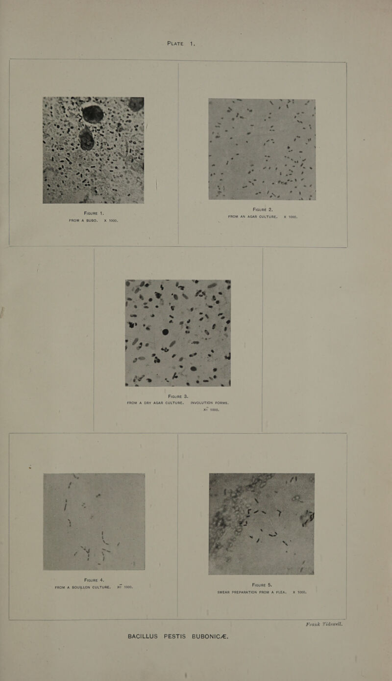   Figure 2. Figure 1. FROM AN AGAR CULTURE. xX 1000, FROM A BUBO.~= X 1000. i re     Figure 3. FROM A DRY AGAR CULTURE. INVOLUTION FORMS. xe 1000.        FROM A BOUILLON CULTURE. xe 1000.   Frank Tidswell. 