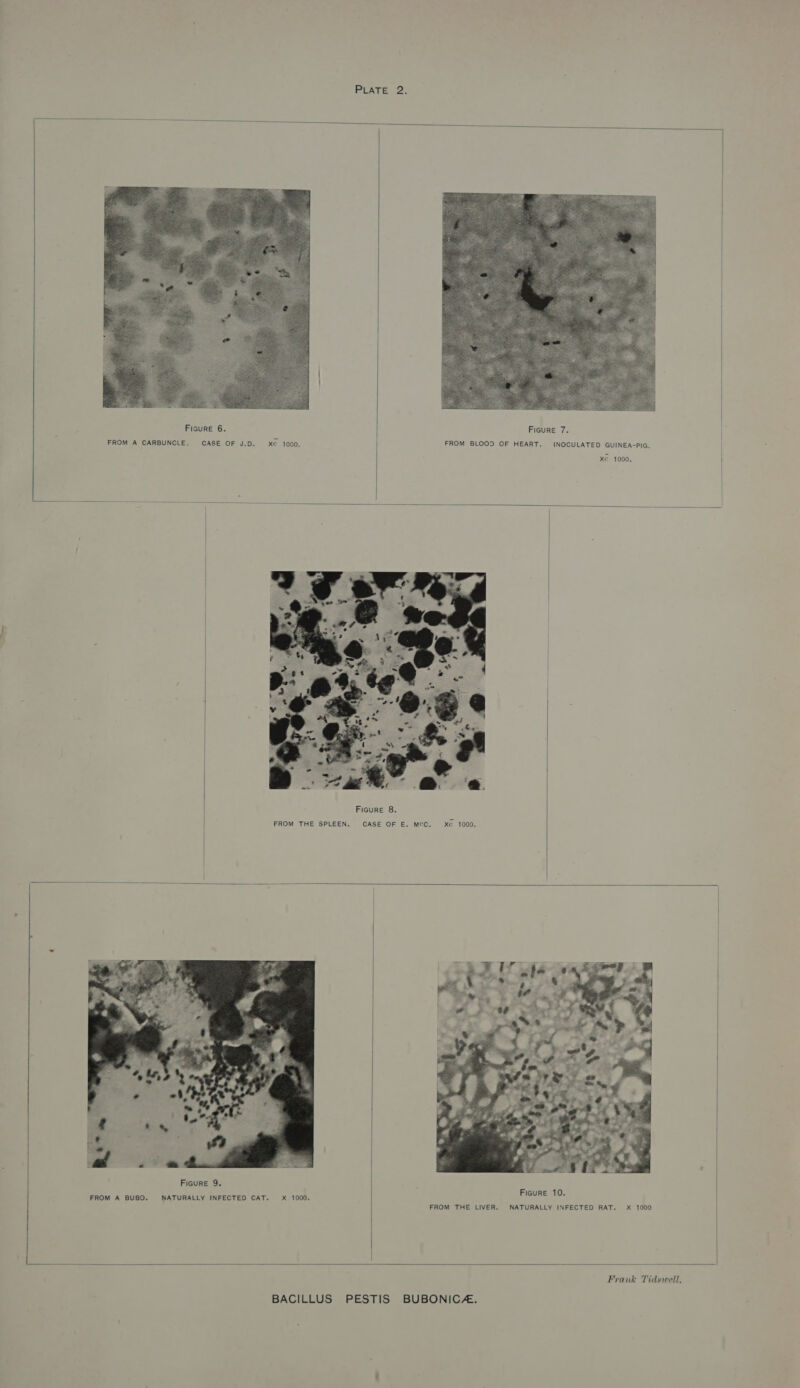   FROM A CARBUNCLE. CASE OF J.D.  xe 1000.   INOCULATED GUINEA-PIG. xe 1000.    FROM THE SPLEEN. CASE OF E. MCC. xe 1000.     FROM A BUBO. x 1000. FROM THE LIVER.  Figure 10. NATURALLY INFECTED RAT. X 1000   