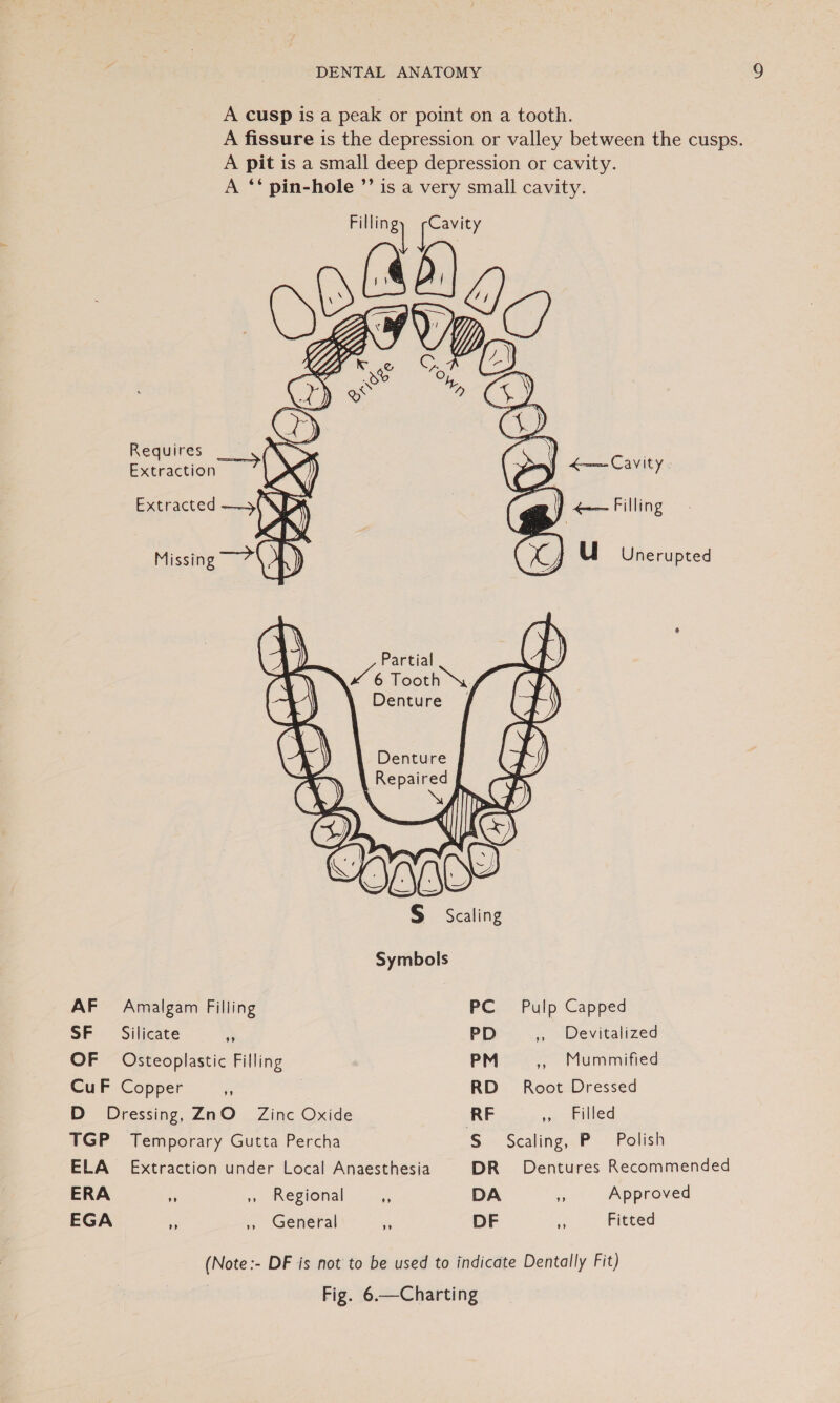 A cusp is a peak or point on a tooth. A fissure is the depression or valley between the cusps. A pit is a small deep depression or cavity. A ** pin-hole ”’ is a very small cavity. pis) (yeu b.     Requires cS Extraction Extracted —» . Partial Ke Tooth \y Denture  S$ Scaling Symbols AF Amalgam Filling PC Pulp Capped SF Silicate 3 PD , Devitalized OF Osteoplastic Filling PM &gt;» Mummmified CuF Copper is RD Root Dressed D Dressing, ZnO Zinc Oxide RF ,, Filled TGP Temporary Gutta Percha S.- Scaling,.P Polish ELA Extraction under Local Anaesthesia DR Dentures Recommended ERA if » Regional __,, DA 64 Approved EGA ip » Genera ¥ DF . Fitted (Note :- DF is not to be used to indicate Dentally Fit) Fig. 6.—Charting