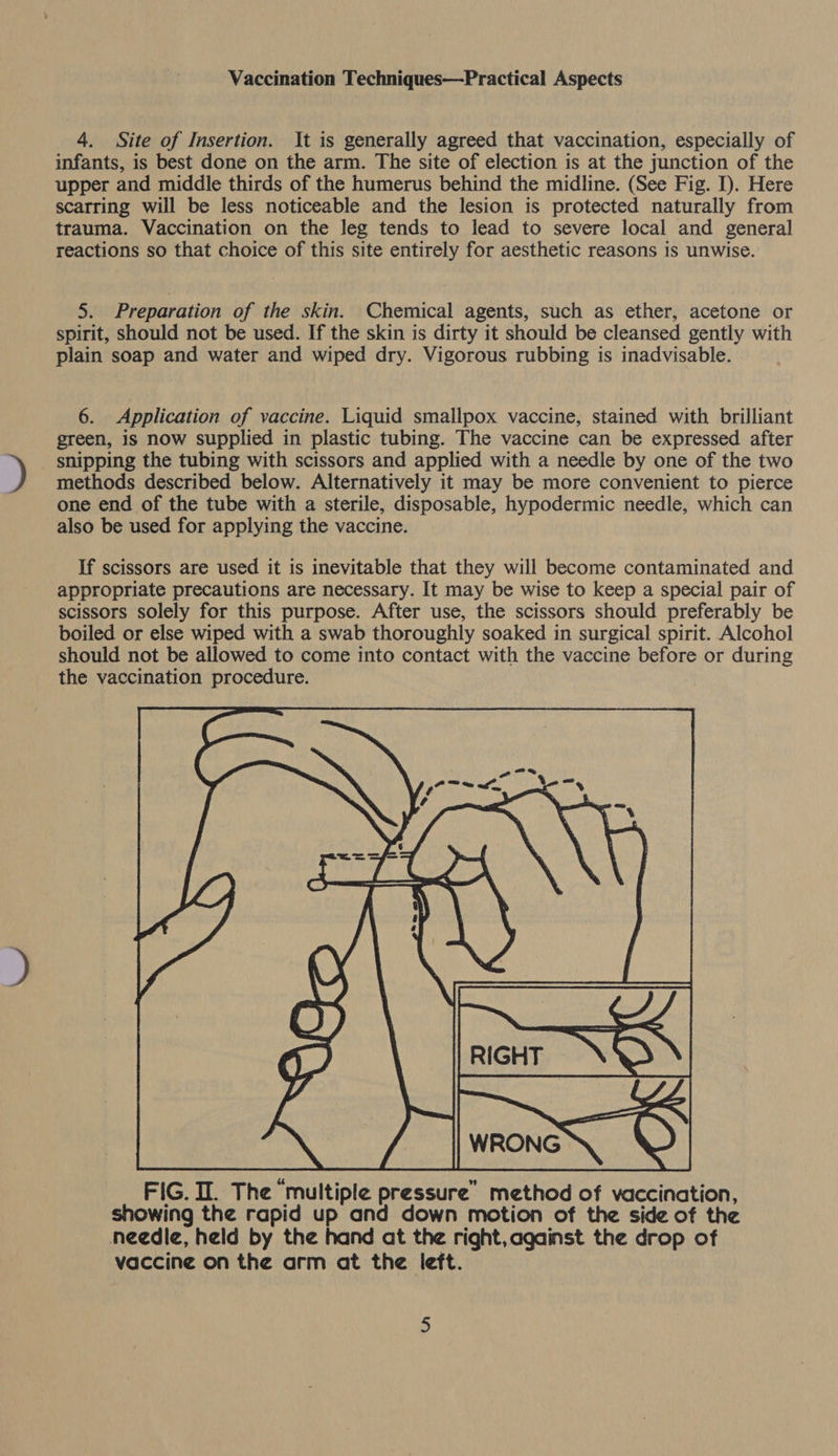Vaccination Techniques—Practical Aspects 4. Site of Insertion. It is generally agreed that vaccination, especially of infants, is best done on the arm. The site of election is at the junction of the upper and middle thirds of the humerus behind the midline. (See Fig. I). Here scarring will be less noticeable and the lesion is protected naturally from trauma. Vaccination on the leg tends to lead to severe local and general reactions so that choice of this site entirely for aesthetic reasons is unwise. » Preparation of the skin. Chemical agents, such as ether, acetone or spirit, should not be used. If the skin is dirty it should be cleansed gently with plain soap and water and wiped dry. Vigorous rubbing is inadvisable. 6. Application of vaccine. Liquid smallpox vaccine, stained with brilliant green, is now supplied in plastic tubing. The vaccine can be expressed after snipping the tubing with scissors and applied with a needle by one of the two methods described below. Alternatively it may be more convenient to pierce one end of the tube with a sterile, disposable, hypodermic needle, which can also be used for applying the vaccine. If scissors are used it is inevitable that they will become contaminated and appropriate precautions are necessary. It may be wise to keep a special pair of scissors solely for this purpose. After use, the scissors should preferably be boiled or else wiped with a swab thoroughly soaked in surgical spirit. Alcohol should not be allowed to come into contact with the vaccine before or during the vaccination procedure.  FIG. II. The ‘multiple pressure’ method of vaccination, showing the rapid up and down motion of the side of the needle, held by the hand at the right, against the drop of vaccine on the arm at the left.