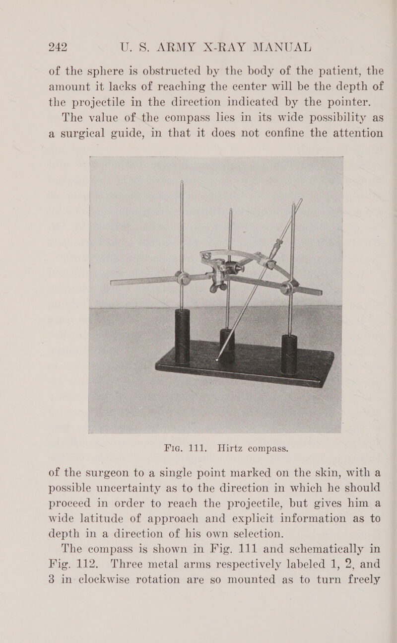 of the sphere is obstructed by the body of the patient, the amount it lacks of reaching the center will be the depth of the projectile in the direction indicated by the pointer. The value of-the compass hes in its wide possibility as a surgical guide, in that it does not confine the attention FE  of the surgeon to a single point marked on the skin, with a possible uncertainty as to the direction in which he should proceed in order to reach the projectile, but gives him a wide latitude of approach and explicit information as to depth in a direction of his own selection. The compass is shown in Fig. 111 and schematically in Fig. 112. Three metal arms respectively labeled 1, 2, and 3 in clockwise rotation are so mounted as to turn freely