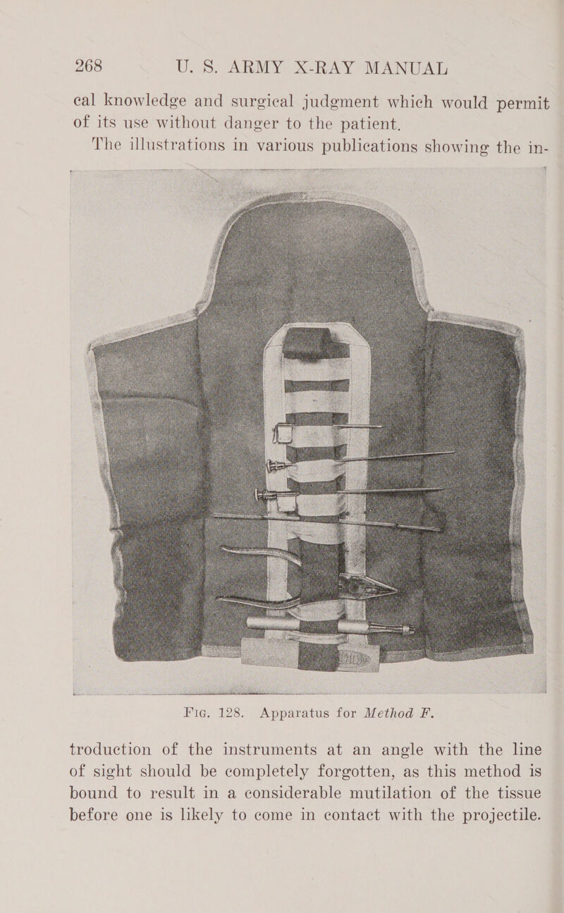 eal knowledge and surgical judgment which would permit of its use without danger to the patient. The illustrations in various publications showing the in-  troduction of the instruments at an angle with the line of sight should be completely forgotten, as this method is bound to result in a considerable mutilation of the tissue before one is likely to come in contact with the projectile.