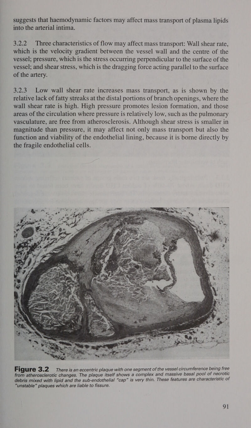 suggests that haemodynamic factors may affect mass transport of plasma lipids into the arterial intima. 3.2.2 Three characteristics of flow may affect mass transport: Wall shear rate, which is the velocity gradient between the vessel wall and the centre of the vessel; pressure, which is the stress occurring perpendicular to the surface of the vessel; and shear stress, which is the dragging force acting parallel to the surface of the artery. 3.2.3. Low wall shear rate increases mass transport, as is shown by the relative lack of fatty streaks at the distal portions of branch openings, where the wall shear rate is high. High pressure promotes lesion formation, and those areas of the circulation where pressure is relatively low, such as the pulmonary vasculature, are free from atherosclerosis. Although shear stress is smaller in magnitude than pressure, it may affect not only mass transport but also the function and viability of the endothelial lining, because it is borne directly by the fragile endothelial cells. 