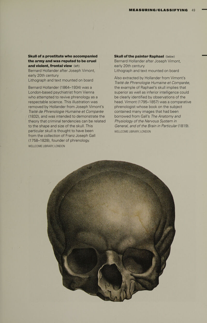 Skull of a prostitute who accompanied the army and was reputed to be cruel and violent, frontal view (left) Bernard Hollander after Joseph Vimont, early 20th century Lithograph and text mounted on board Bernard Hollander (1864-1934) was a London-based psychiatrist from Vienna who attempted to revive phrenology as a respectable science. This illustration was removed by Hollander from Joseph Vimont's Traite de Phrenologie Humaine et Comparee (1832), and was intended to demonstrate the theory that criminal tendencies can be related to the shape and size of the skull. This particular skull is thought to have been from the collection of Franz Joseph Gall (1758-1828), founder of phrenology. WELLCOME LIBRARY, LONDON Skull of the painter Raphael (below) Bernard Hollander after Joseph Vimont, early 20th century Lithograph and text mounted on board Also extracted by Hollander from Vimont's Traite de Phrenologie Humaine et Comparee, the example of Raphael's skull implies that superior as well as inferior intelligence could be clearly identified by observations of the head. Vimont (1795-1857) was a comparative phrenologist whose book on the subject contained many images that had been borrowed from Gall's The Anatomy and Physiology of the Nervous System in General, and of the Brain in Particular (1819). WELLCOME LIBRARY, LONDON