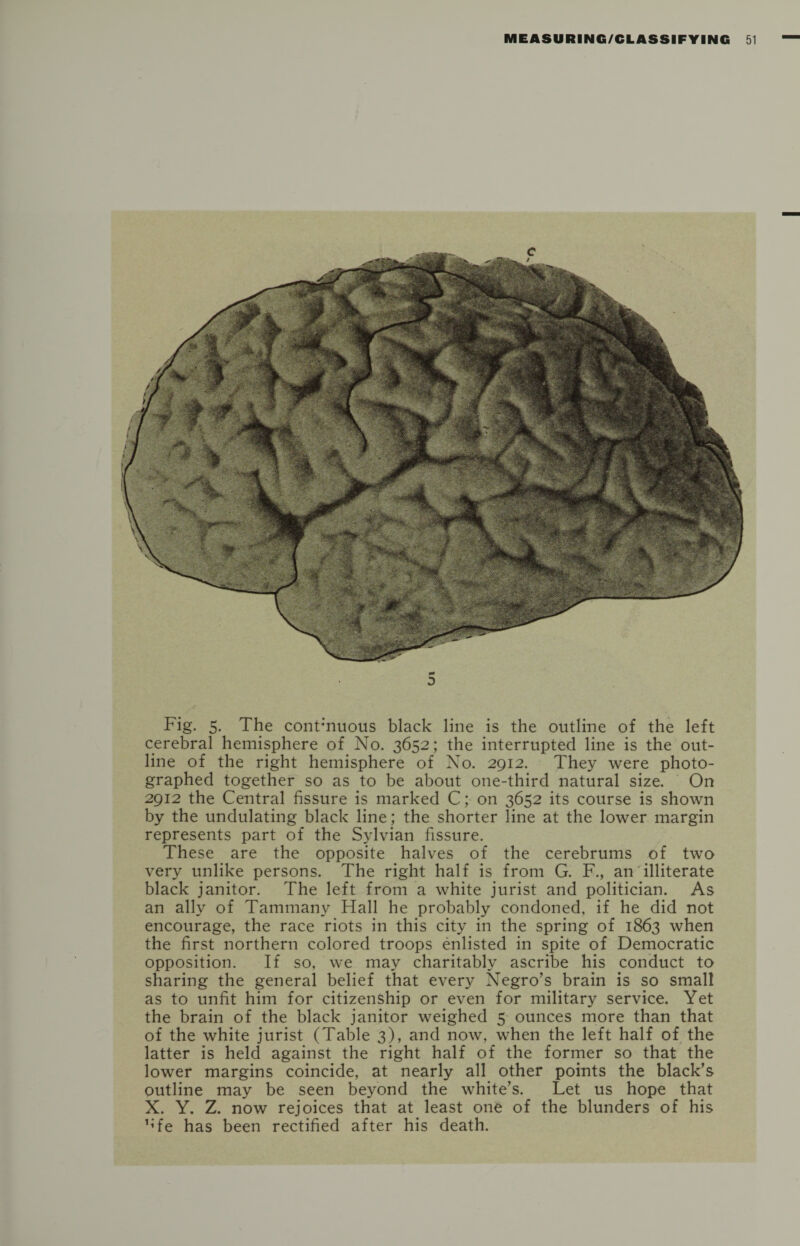 p* D Fig. 5. The continuous black line is the outline of the left cerebral hemisphere of No. 3652; the interrupted line is the out¬ line of the right hemisphere of No. 2912. They were photo¬ graphed together so as to be about one-third natural size. On 2912 the Central fissure is marked C; on 3652 its course is shown by the undulating black line ; the shorter line at the lower margin represents part of the Sylvian fissure. These are the opposite halves of the cerebrums of two very unlike persons. The right half is from G. F., an illiterate black janitor. The left from a white jurist and politician. As an ally of Tammany Hall he probably condoned, if he did not encourage, the race riots in this city in the spring of 1863 when the first northern colored troops enlisted in spite of Democratic opposition. If so, we may charitably ascribe his conduct to sharing the general belief that every Negro’s brain is so small as to unfit him for citizenship or even for military service. Yet the brain of the black janitor weighed 5 ounces more than that of the white jurist (Table 3), and now, when the left half of the latter is held against the right half of the former so that the lower margins coincide, at nearly all other points the black’s outline may be seen beyond the white’s. Let us hope that X. Y. Z. now rejoices that at least one of the blunders of his Me has been rectified after his death.