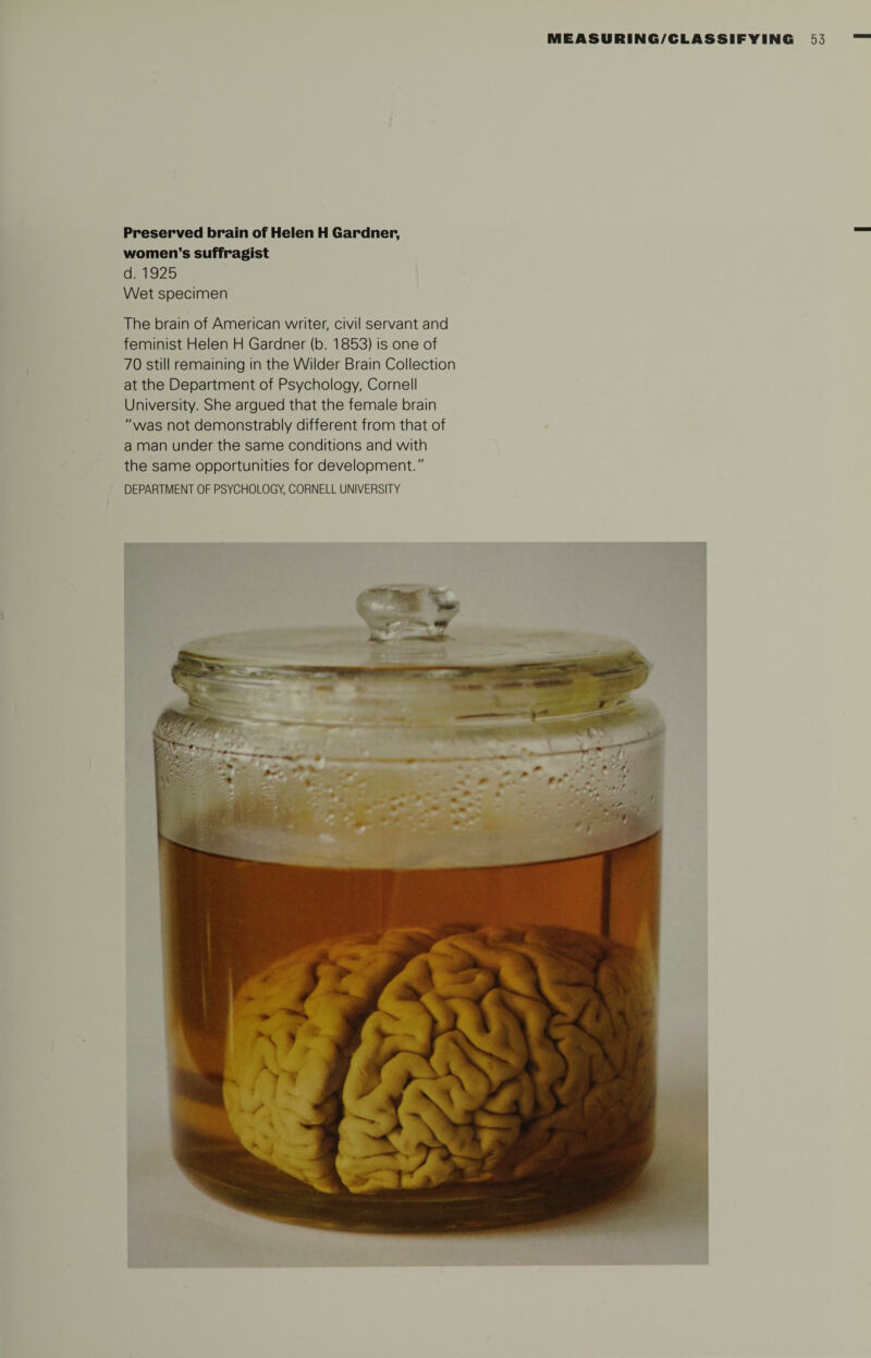 Preserved brain of Helen H Gardner, women’s suffragist d. 1925 Wet specimen The brain of American writer, civil servant and feminist Helen H Gardner (b. 1853) is one of 70 still remaining in the Wilder Brain Collection at the Department of Psychology, Cornell University. She argued that the female brain was not demonstrably different from that of a man under the same conditions and with the same opportunities for development.