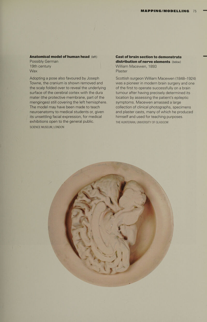 Anatomical model of human head (left) Possibly German 19th century Wax Adopting a pose also favoured by Joseph Towne, the cranium is shown removed and the scalp folded over to reveal the underlying surface of the cerebral cortex with the dura mater (the protective membrane, part of the menginges) still covering the left hemisphere. The model may have been made to teach neuroanatomy to medical students or, given its unsettling facial expression, for medical exhibitions open to the general public. SCIENCE MUSEUM, LONDON Cast of brain section to demonstrate distribution of nerve elements (below) William Macewen, 1893 Plaster Scottish surgeon William Macewen (1848-1924) was a pioneer in modern brain surgery and one of the first to operate successfully on a brain tumour after having precisely determined its location by assessing the patient's epileptic symptoms. Macewen amassed a large collection of clinical photographs, specimens and plaster casts, many of which he produced himself and used for teaching purposes. THE HUNTERIAN, UNIVERSITY OF GLASGOW / * t