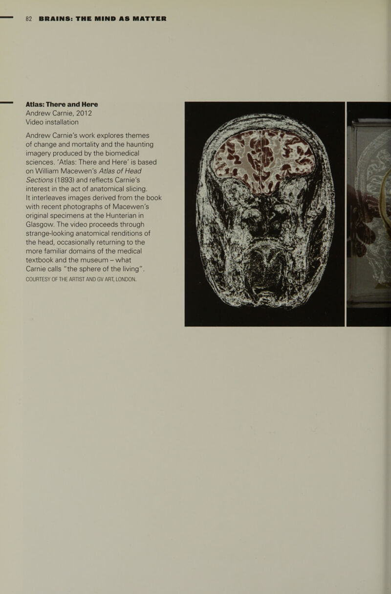 Atlas: There and Here Andrew Carnie, 2012 Video installation Andrew Carnie's work explores themes of change and mortality and the haunting imagery produced by the biomedical sciences. 'Atlas: There and Here' is based on William Macewen's Atlas of Head Sections (1893) and reflects Carnie's interest in the act of anatomical slicing. It interleaves images derived from the book with recent photographs of Macewen's original specimens at the Hunterian in Glasgow. The video proceeds through strange-looking anatomical renditions of the head, occasionally returning to the more familiar domains of the medical textbook and the museum - what Carnie calls the sphere of the living.
