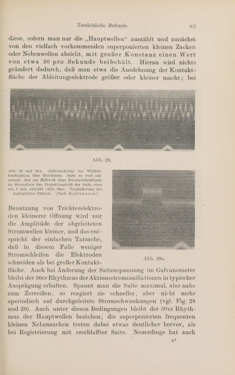 diese, sofern man nur die „Hauptwellen“ auszählt und zunächst von den vielfach vorkommenden superponierten kleinen Zacken oder Nebenwellen absieht, mit großer Konstanz einen Wert von etwa 50 pro Sekunde beibehält. Hieran wird nichts geändert dadurch, daß man etwa die Ausdehnung der Kontakt- fläche der Ableitungselektrode größer oder kleiner macht; bei Abb. 28. Abb. 28 und 28a. Aktionsströme bei Willkür- kontraktion 50er Rhythmus. Saite so weit ent- spannt, daß ein Millivolt ohne Zusatzwiderstände im Stromkreis das Projektionsbild der Saite etwa um 7 mm ablenkt (Abb. 28a). Vergrößerung des Saitenbildes 700fach. (Nach Kohlrausch.) Benutzung von Trichterelektro- den kleinerer Öffnung wird nur die Amplitüde der abgeleiteten Stromwellen kleiner, und das ent- spricht der einfachen Tatsache, daß in diesem Falle weniger Stromschleifen die Elektroden schneiden als bei großer Kontakt- fläche. Auch bei Änderung der Saitenspannung im Galvanometer bleibt der 50er Rhythmus der Aktionsstromoszillationen in typischer Ausprägung erhalten. Spannt man die Saite maximal, also nahe zum Zerreißen, so reagiert sie schneller, aber nicht mehr aperiodisch auf durchgeleitete Stromschwankungen (vgl. Fig. 28 und 29). Auch unter diesen Bedingungen bleibt der 50er Rhyth- mus der Hauptwellen bestehen; die superponierten frequenten kleinen Nebenzacken treten dabei etwas deutlicher hervor, als bei Registrierung mit erschlaffter Saite. Neuerdings hat auch 6*