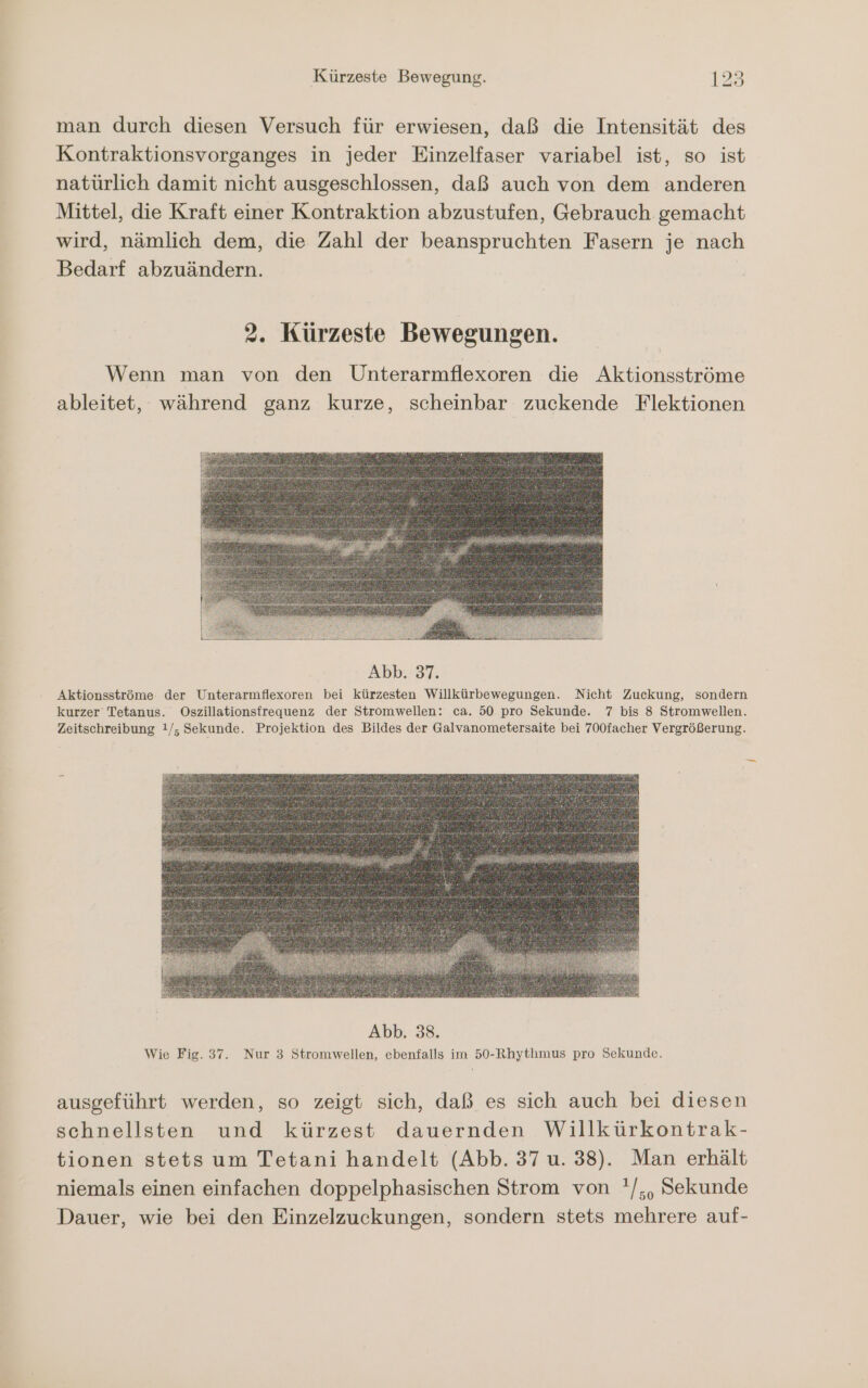 man durch diesen Versuch für erwiesen, daß die Intensität des Kontraktionsvorganges in jeder Einzelfaser variabel ist, so ist natürlich damit nicht ausgeschlossen, daß auch von dem anderen Mittel, die Kraft einer Kontraktion abzustufen, Gebrauch gemacht wird, nämlich dem, die Zahl der beanspruchten Fasern je nach Bedarf abzuändern. 2. Kürzeste Bewegungen. Wenn man von den Unterarmflexoren die Aktionsströme ableitet, während ganz kurze, scheinbar zuckende Flektionen Abb. 37. Aktionsströme: der Unterarmflexoren bei kürzesten Willkürbewegungen. Nicht Zuckung, sondern kurzer Tetanus. Oszillationsfregquenz der Stromwellen: ca. 50 pro Sekunde. 7 bis 8 Stromwellen. Zeitschreibung !/, Sekunde. Projektion des Bildes der Galvanometersaite bei 700facher Vergrößerung. — ausgeführt werden, so zeigt sich, daß es sich auch bei diesen schnellsten und kürzest dauernden Willkürkontrak- tionen stets um Tetani handelt (Abb. 37 u. 38). Man erhält niemals einen einfachen doppelphasischen Strom von '/,, Sekunde Dauer, wie bei den Einzelzuckungen, sondern stets mehrere auf-