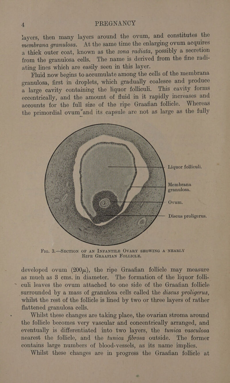 layers, then many layers around the ovum, and constitutes the membrana granulosa. At the same time the enlarging ovum acquires a thick outer coat, known as the zona radiata, possibly a secretion from the granulosa cells. The name is derived from the fine radi- ating lines which are easily seen in this layer. Fluid now begins to accumulate among the cells of the membrana eranulosa, first in droplets, which gradually coalesce and produce a large cavity containing the liquor folliculi. This cavity forms eccentrically, and the amount of fluid in it rapidly icreases and accounts for the full size of the ripe Graafian follicle. Whereas the primordial ovum’and its capsule are not as large as the fully Liquor folliculi. Membrana granulosa. —— Discus proligerus. Fig. 3.—SECTION OF AN INFANTILE OVARY SHOWING A NEARLY RiezE GRAAFIAN FOLLICLE. developed ovum (200), the ripe Graafian follicle may measure as much as 8 cms. in diameter. The formation of the liquor folli- culi leaves the ovum attached to one side of the Graafian follicle surrounded by a mass of granulosa cells called the discus protigerus, whilst the rest of the follicle is lined by two or three layers of rather flattened granulosa cells. Whilst these changes are taking place, the ovarian stroma around the follicle becomes very vascular and concentrically arranged, and eventually is differentiated into two layers, the tunica vasculosa nearest the follicle, and the tunica fibrosa outside. The former contains large numbers of blood-vessels, as its name implies. Whilst these changes are in progress the Graafian follicle at