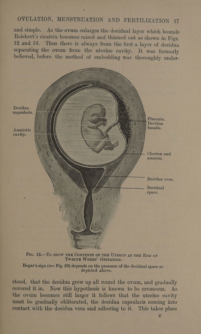 and simple. As the ovum enlarges the decidual layer which bounds Reichert’s cicatrix becomes raised and thinned out as shown in Figs. 12 and 18. Thus there is always from the first a layer of decidua separating the ovum from the uterine cavity. It was formerly believed, before the method of embedding was thoroughly under- Decidua capsularis. Placenta Decidua basalis Amniotic cavity. Chorion and amnion. Decidua vera. Decidual space. Fic. 13.—To sHow tur Contents of THE UrErus AT THE END oF TWELVE WEEKS’ GESTATION. Hegar’s sign (see Fig. 29) depends on the presence of the decidual space as depicted above. stood, that the decidua grew up all round the ovum, and gradually covered it in. Now this hypothesis is known to be erroneous. As the ovum becomes still larger it follows that the uterine cavity must be gradually obliterated, the decidua capsularis coming into contact with the decidua vera and adhering to it. This takes place C