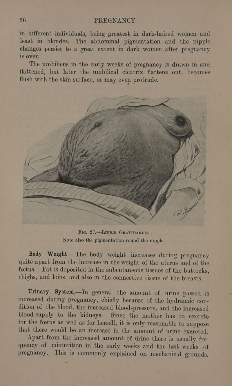 in different individuals, bemg greatest in dark-haired women and least im blondes. The abdominal pigmentation and the nipple changes persist to a great extent in dark women after pregnancy 18 Over. | The umbilicus mm the early weeks of pregnancy is drawn in and flattened, but later the umbilical cicatrix flattens out, becomes flush with the skin surface, or may even protrude. Note also the pigmentation round the nipple. Body Weight.—The body weight increases during pregnancy quite apart from the increase in the weight of the uterus and of the foetus. Fat is deposited in the subcutaneous tissues of the buttocks, thighs, and loins, and also in the connective tissue of the breasts. Urinary System.—In general the amount of urine passed is increased during pregnancy, chiefly because of the hydremic con- dition of the blood, the increased blood-pressure, and the increased blood-supply to the kidneys. Since the mother has to excrete for the foetus as well as for herself, it is only reasonable to suppose that there would be an increase in the amount of urine excreted. Apart from the increased amount of tirine there is usually fre- quency of micturition in the early weeks and the last weeks of pregnancy. This is commonly explained on mechanical grounds. he