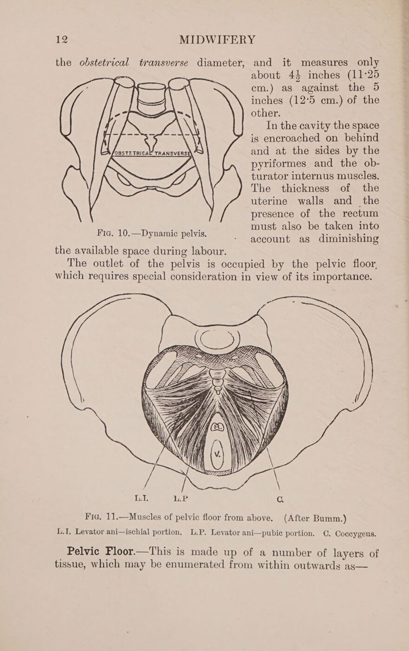 about 4% inches (11°25 cm.) as against the 5 inches (12°5 cm.) of the other. In the cavity the space is encroached on behind and at the sides by the pyriformes and the ob- turator internus muscles. The thickness of the uterine walls and _ the presence of the rectum must also be taken into account as diminishing L.I. Leyator ani—ischial portion.