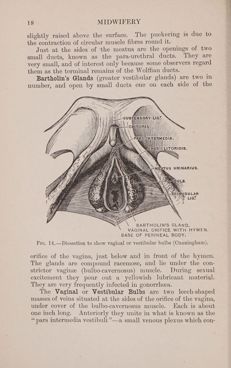 slightly raised above the surface. The puckering is due to the contraction of circular muscle fibres round it. Just at the sides of ‘the meatus are the openings of two small ducts, known as the para-urethral ducts. They are very small, and of interest only because some observers regard them as the terminal remains of the Wolffian ducts. Bartholin’s Glands (greater vestibular glands) are two in number, and open by small ducts one on each side of the BARTHOLIN’S GLAND. VAGINAL ORIFICE WITH HYMEN. BASE OF PERINEAL BODY. Fic. 14,—Dissection to show vaginal or vestibular bulbs (Cunningham). orifice of the vagina, just below and in front of the hymen. The glands are compound racemose, and lie under the con- strictor vaginee (bulbo-cavernosus) muscle. During sexual excitement they pour out a yellowish lubricant material. They are very frequently infected in gonorrhcea. The Vaginal or Vestibular Bulbs are two leech-shaped masses of veins situated at the sides of the orifice of the vagina, under cover of the bulbo-cavernosus muscle. Each is about one inch long. Anteriorly they unite in what is known as the ‘pars intermedia vestibuli ”—a small venous plexus which con-