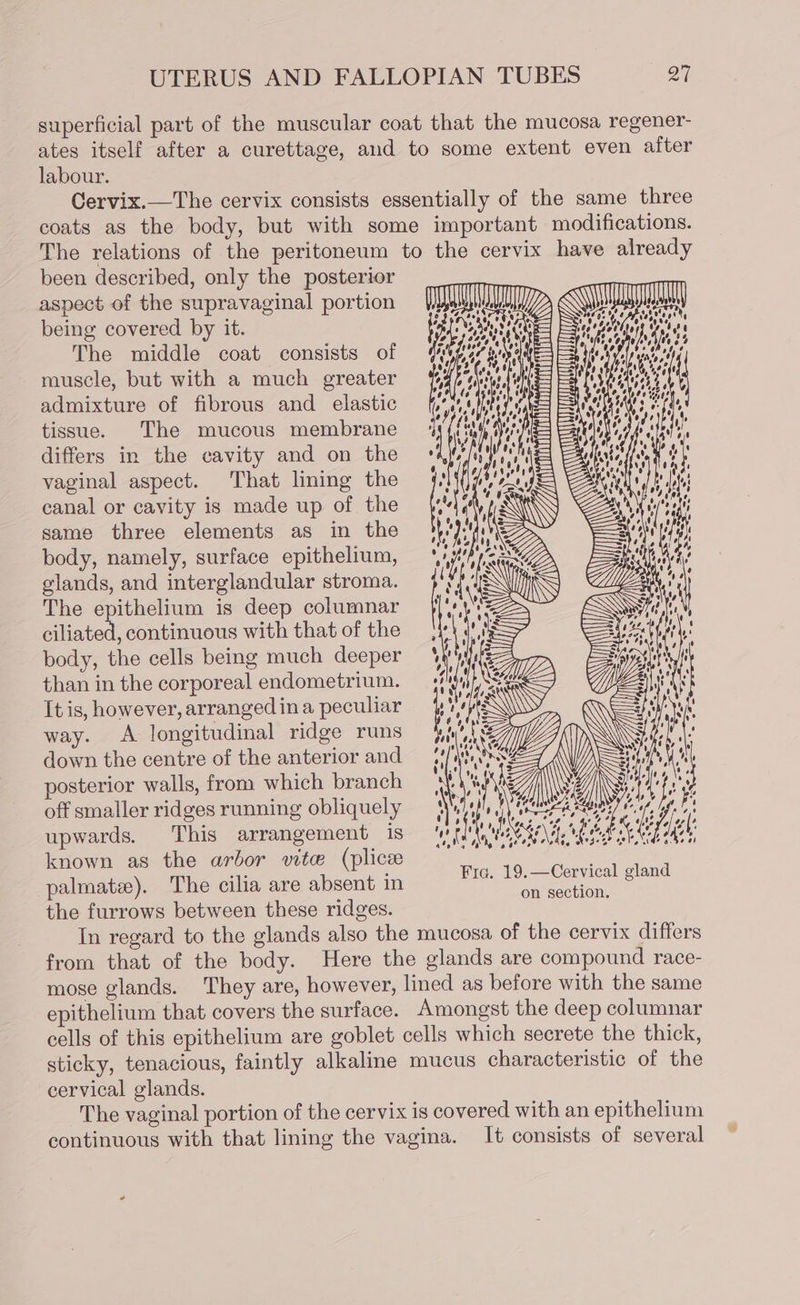 labour. been described, only the posterior aspect of the supravaginal portion being covered by it. The middle coat consists of muscle, but with a much greater admixture of fibrous and elastic tissue. The mucous membrane differs in the cavity and on the vaginal aspect. That lining the canal or cavity is made up of the same three elements as in the body, namely, surface epithelium, glands, and interglandular stroma. The epithelium is deep columnar ciliated, continuous with that of the body, the cells being much deeper than in the corporeal endometrium. It is, however, arranged ina peculiar way. A longitudinal ridge runs down the centre of the anterior and posterior walls, from which branch off smaller ridges running obliquely upwards. This arrangement is known as the arbor vite (plice palmatz). The cilia are absent in the furrows between these ridges. D&gt; &lt;a ? ZA, SSSA ealap nt SAAC LOSE = =e oeltoy O75 ra e4 =e lt 02 —— 4 OP yf, ¢ ES 3 ti ieee \ t) é FSIS Uae =I= hw W068 &amp;) — = o} f iy r) Ee Cale Noes obo == 7G wet i} Slay ay eae Baltes fa ol = ES un ov) wh ‘ — 4 SS Y LU \ MN oie = = &lt;&gt; = e4, 4 4 by % ook &gt; 0 4 Wy IRN eZ G7; 5 le Hei LLG. io Ze Ss ‘ 44 one ’ ve m Men, oe ) hel, \ a 4 we, RY, VY) 1G : ‘ ot | Yy [es i , . % WA / 4, 40 o tole ‘ 4/4 ae 4 x 49 Ky 4 ) aah Wal) hese Heres s/o a as 4 d Uden LAW oN Of : eG eo oie APA 0 f 4 ' vy} i \ fe fe, oe As fo) Xx the A he 0 60 08 Ke ROSS Ng 4% 0. be at Fic. 19.—Cervical gland on section. mose glands. cervical glands. It consists of several