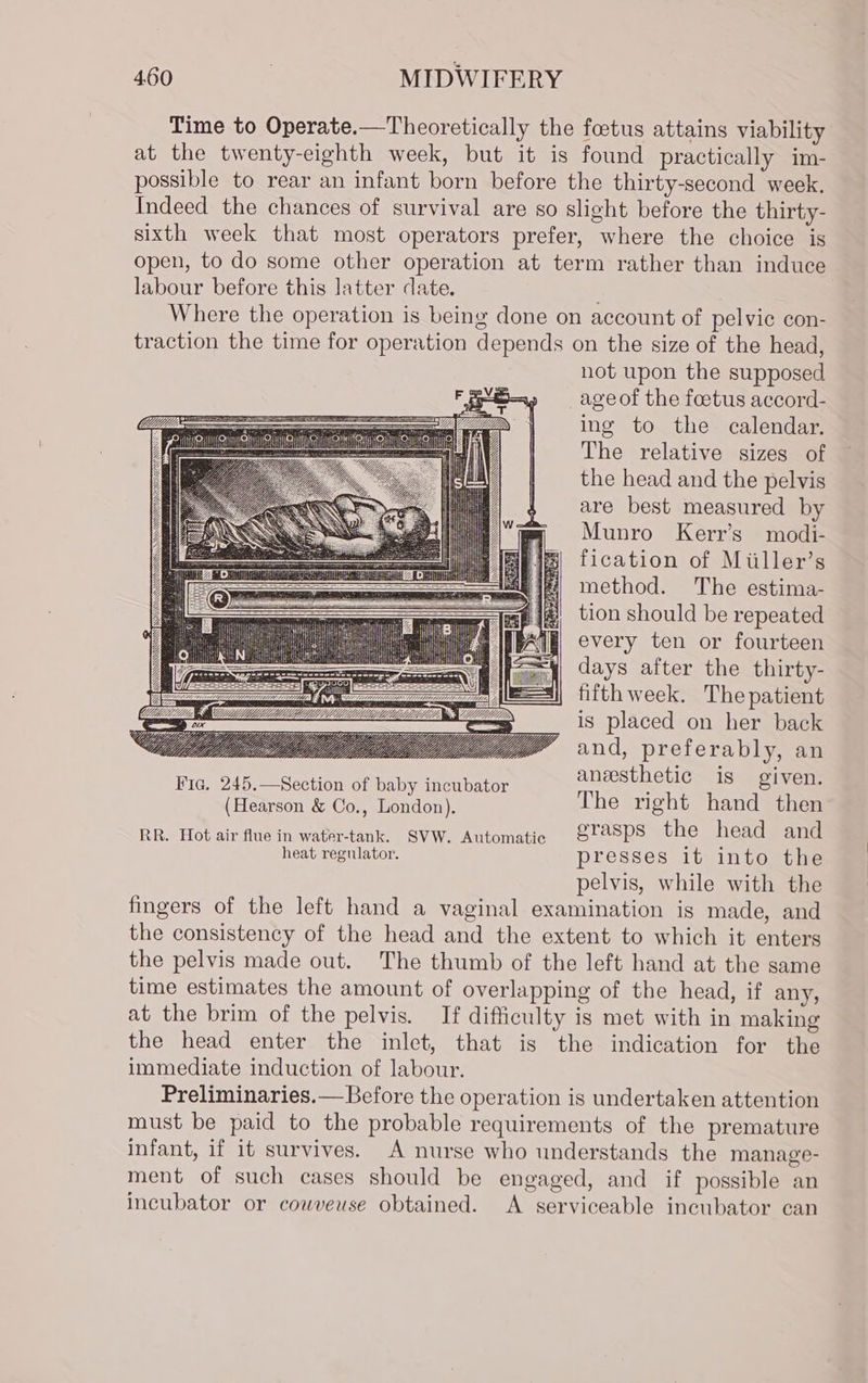 Time to Operate.—Theoretically the foetus attains viability at the twenty-eighth week, but it is found practically im- possible to rear an infant born before the thirty-second week, Indeed the chances of survival are so slight before the thirty- sixth week that most operators prefer, where the choice is open, to do some other operation at term rather than induce labour before this latter date. Where the operation is being done on account of pelvic con- traction the time for operation depends on the size of the head, not upon the supposed age of the foetus accord- ing to the calendar. The relative sizes of the head and the pelvis are best measured by Munro Kerr’s modi- fication of Miiller’s method. The estima- tion should be repeated every ten or fourteen days after the thirty- fifth week. The patient is placed on her back and, preferably, an anesthetic is given. Fig. 245.—Section of baby incubator : (Hearson &amp; Co., London). The right hand then RR. Hot air flue in water-tank. SVW. Automatic S@Sps the head and heat regulator. presses it inte the pelvis, while with the fingers of the left hand a vaginal examination is made, and the consistency of the head and the extent to which it enters the pelvis made out. The thumb of the left hand at the same time estimates the amount of overlapping of the head, if any, at the brim of the pelvis. If difficulty is met with in making the head enter the inlet, that is the indication for the immediate induction of labour. Preliminaries.— Before the operation is undertaken attention must be paid to the probable requirements of the premature infant, if it survives. A nurse who understands the manage- ment of such cases should be engaged, and if possible an incubator or couveuse obtained. A serviceable incubator can