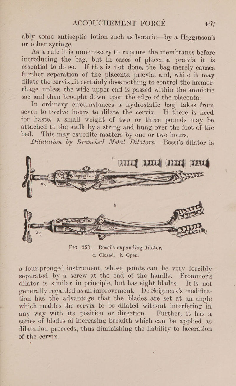 ably some antiseptic lotion such as boracic—by a Higginson’s or other syringe. : As a rule it is unnecessary to rupture the membranes before introducing the bag, but in cases of placenta previa it is essential to do so. If this is not done, the bag merely causes further separation of the placenta praevia, and, while it may dilate the cervix,.it certainly does nothing to control the hemor- rhage unless the wide upper end is passed within the amniotic sac and then brought down upon the edge of the placenta. In ordinary circumstances a hydrostatic bag takes from seven to twelve hours to dilate the cervix. If there is need for haste, a small weight of two or three pounds may be attached to the stalk by a string and hung over the foot of the bed. This may expedite matters by one or two hours. Dilatation by Branched Metal Dilators.—Bossi’s dilator is a four-pronged instrument, whose points can be very forcibly separated by a screw at the end of the handle. Frommer’s dilator is similar in principle, but has eight blades. It is not generally regarded as an improvement. De Seigneux’s modifica- tion has the advantage that the blades are set at an angle which enables the cervix to be dilated without interfering in any way with its position or direction. Further, it has a series of blades of increasing breadth which can be applied as - dilatation proceeds, thus diminishing the liability to laceration of the cervix.