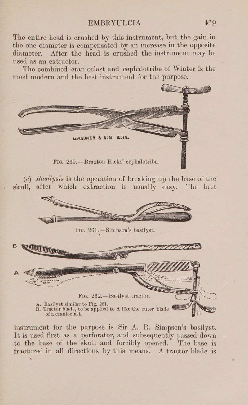 The entire head is crushed by this instrument, but the gain in the one diameter is compensated by an increase in the opposite diameter. After the head is crushed the instrument may be used as an extractor. The combined cranioclast and cephalotribe of Winter is the most modern and the best instrument for the purpose. GARDNER &amp; SUN EUIN. Fic. 260.—Braxton Hicks’ cephalotribe. (c) Basilysis is the operation of breaking up the base of the skull, after which extraction is usually easy. The best Ere. 261. 0-y ete 2 szziiTU’” Ganoxer &amp; SON ‘ EciIN pease ° Oe i SS. ee ete ee eee ° eee wcnce ee” Fic. 262.—Basilyst tractor. A. Basilyst similar to Fig. 261. B. Tractor blade, to be applied to A like the outer blade of a cranioclast. instrument for the purpose is Sir A. R. Simpson’s basilyst. It is used first as a perforator, and subsequently passed down to the base of the skull and forcibly opened. The base is fractured in all directions by this means. A tractor blade is