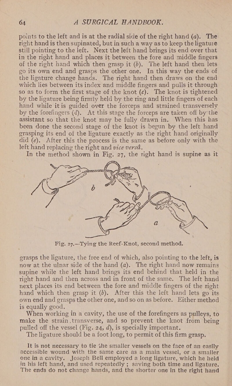points to the left and is at the radial side of the right hand (a). The right hand is then supinated, but in such a way as to keep the ligature still pointing to the left. Next the left hand brings its end over that in the right hand and places it between the fore and middle fingers of the right hand which then grasp it (6). The left hand then lets go its own end and grasps the other one. In this way the ends of the ligature change hands. The right hand then draws on the end which lies between its index and middle fingers and pulls it through so as to form the first stage of the knot (¢). The knot is tightened by the ligature being firmly held by the ring and little fingers of each hand while itis guided over the forceps and strained transversely by the forefingers (2). At this stage the forceps are taken off by the assistant so that the knot may be fully drawn in. When this has been done the second stage of the knot is begun by the left hand grasping its end of the ligature exactly as the right hand originally did (e). After this the process is the same as before only with the left hand replacing the right and vice versd. In the method shown in Fig. 27, the right hand is supine as it grasps the ligature, the free end of which, also pointing to the left, is now at the ulnar side of the hand (a). The right hand now remains supine while the left hand brings its end behind that held in the right hand and then across and in front of the same. The left hand next places its end between the fore and middle fingers of the right hand which then grasp it (2). After this the left hand lets go its own end and grasps the other one, andso on as before. Either methad is equally good. When working in a cavity, the use of the forefingers as pulleys, to make the strain transverse, and so prevent the knot from being pulled off the vessel (Fig. 24, d), is specially important. The ligature should be a foot long, to permit of this firm grasp. It is not necessary to tie «he smaller vessels on the face of an easily accessible wound with the same care as a main vessel, or a smaller one inacavity. Joseph Bell employed a long ligature, which he held in his left hand, and used repeatedly ; saving both time and ligature. The ends do not change hands, and the shorter one in the right hand