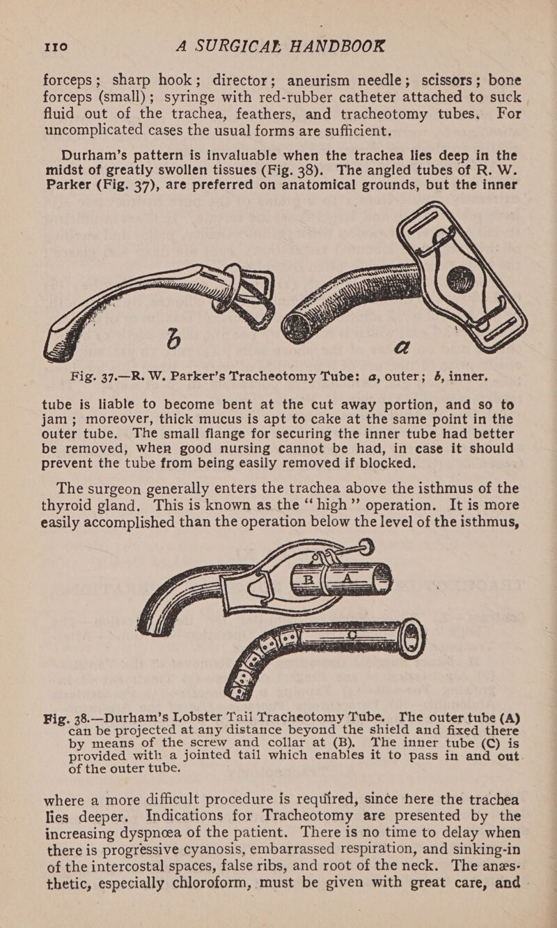 forceps; sharp hook; director; aneurism needle; scissors; bone forceps (small); syringe with red-rubber catheter attached to suck fluid out of the trachea, feathers, and tracheotomy tubes. For uncomplicated cases the usual forms are sufficient. Fig. 37.—R. W. Parker’s Tracheotomy Tube: a, outer; 4, inner. tube is liable to become bent at the cut away portion, and so to jam ; moreover, thick mucus is apt to cake at the same point in the outer tube. The small flange for securing the inner tube had better be removed, when good nursing cannot be had, in ease it should prevent the tube from being easily removed if blocked. The surgeon generally enters the trachea above the isthmus of the thyroid gland. This is known as the “‘high”’ operation. It is more easily accomplished than the operation below the level of the isthmus, Fig. 38.—Durham’s Lobster Tail Tracheotomy Tube. The outer tube (A) can be projected at any distance beyond the shield and fixed there by means of the screw and collar at (B) The inner tube (C) is provided with a jointed tail which enables it to pass in and out of the outer tube. where a more difficult procedure is required, since here the trachea lies deeper. Indications for Tracheotomy are presented by the increasing dyspncea of the patient. There is no time to delay when there is progressive cyanosis, embarrassed respiration, and sinking-in of the intercostal spaces, false ribs, and root of the neck. The anes- thetic, especially chloroform, must be given with great care, and