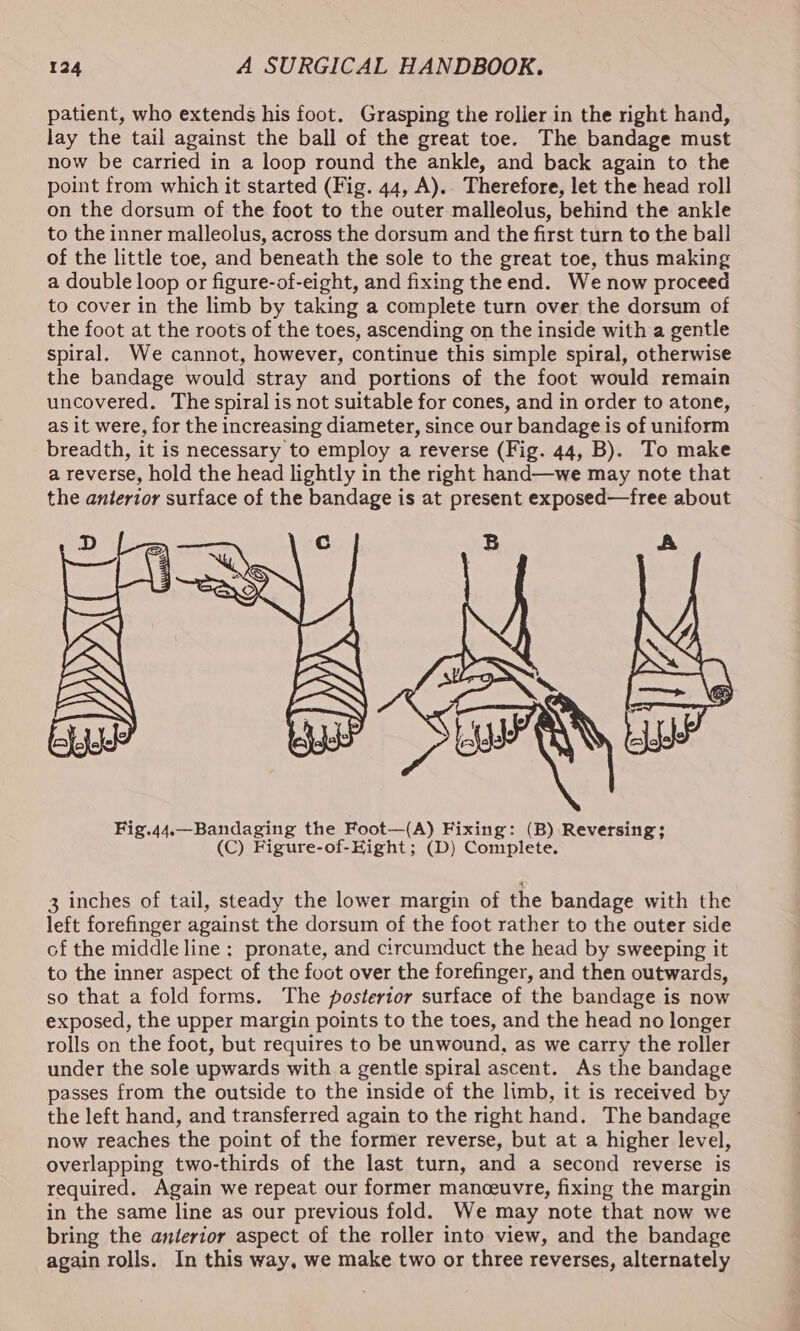 patient, who extends his foot. Grasping the roller in the right hand, lay the tail against the ball of the great toe. The bandage must now be carried in a loop round the ankle, and back again to the point from which it started (Fig. 44, A).. Therefore, let the head roll on the dorsum of the foot to the outer malleolus, behind the ankle to the inner malleolus, across the dorsum and the first turn to the ball of the little toe, and beneath the sole to the great toe, thus making a double loop or figure-of-eight, and fixing the end. We now proceed to cover in the limb by taking a complete turn over the dorsum of the foot at the roots of the toes, ascending on the inside with a gentle spiral. We cannot, however, continue this simple spiral, otherwise the bandage would stray and portions of the foot would remain uncovered. The spiral is not suitable for cones, and in order to atone, as it were, for the increasing diameter, since our bandage is of uniform breadth, it is necessary to employ a reverse (Fig. 44, B). To make a reverse, hold the head lightly in the right hand—we may note that the anterior surface of the bandage is at present exposed—free about 3 inches of tail, steady the lower margin of the bandage with the left forefinger against the dorsum of the foot rather to the outer side of the middle line: pronate, and circumduct the head by sweeping it to the inner aspect of the foot over the forefinger, and then outwards, so that a fold forms. The postertor surface of the bandage is now exposed, the upper margin points to the toes, and the head no longer rolls on the foot, but requires to be unwound, as we carry the roller under the sole upwards with a gentle spiral ascent. As the bandage passes from the outside to the inside of the limb, it is received by the left hand, and transferred again to the right hand. The bandage now reaches the point of the former reverse, but at a higher level, overlapping two-thirds of the last turn, and a second reverse is required. Again we repeat our former manceuvre, fixing the margin in the same line as our previous fold. We may note that now we bring the anterior aspect of the roller into view, and the bandage again rolls. In this way, we make two or three reverses, alternately