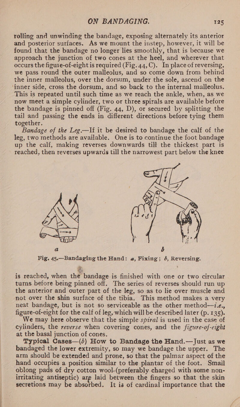 rolling and unwinding the bandage, exposing alternately its anterior and posterior surfaces. As we mount the instep, however, it will be found that the bandage no longer lies smoothly, that is because we approach the junction of two cones at the heel, and wherever that occurs the figuie-of-eight is required (Fig. 44,C). In place of reversing, we pass round the outer malleolus, and so come down from behind the inner malleolus, over the dorsum, under the sole, ascend on the This is repeated until such time as we reach the ankle, when, as we now meet a simple cylinder, two or three spirals are available before the bandage is pinned off (Fig. 44, D), or secured ‘by splitting the tail and passing the ends in different directions before tying them together. Bandage of the Leg.—If it be desired to bandage the calf of the leg, two methods are available. One is to continue the foot bandage up the calf, making reverses downwards till the thickest part is reached, then reverses upwards till the narrowest part below the knee Fig. 45.—Bandaging the Hand: a, Fixing; 4, Reversing. SS ? is reached, when the bandage is finished with one or two circular turns before being pinned off. The series of reverses should run up the anterior and outer part of the leg, so as to lie over muscle and not over the shin surface of the tibia. This method makes a very neat bandage, but is not so serviceable as the other method—z.e., figure-of-eight for the calf of leg, which will be described later (p. 135). We may here observe that the simple spiral is used in the case of cylinders, the reverse when covering cones, and the figure-of-eight at the basal junction of cones. Typical Cases—(4) How to Bandage the Hand.—Just as we bandaged the lower extremity, so may we bandage the upper. The arm should be extended and prone, so that the palmar aspect of the hand occupies a position similar to the plantar of the foot. Smail oblong pads of dry cotton wool-(preferably charged with some non- irritating antiseptic) arg laid between the fingers so that the skin secretions may be absorbed. It is of cardinal importance that the
