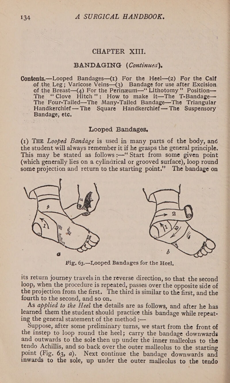 CHAPTER XIII. BANDAGING (Continuea). Contents.—Looped Bandages—(1) For the Heel—(z) For the Calf of the Leg; Varicose Veins—(3) Bandage for use after Excision. of the Breast—(4) For the Perineum—‘“ Lithotomy”’ Position— The ‘Clove Hitch’?: How to make it—The T-Bandage— The Four-Tailed—The Many-Tailed Bandage—The Triangular Handkerchief — The Square Handkerchief—The Suspensory Bandage, etc. Looped Bandages. (1) THE Looped Bandage is used in many parts of the body, ane the student will always remember it if he grasps the general principle. This may be stated as follows :—‘‘ Start from some given point (which generally lies on a cylindrical or grooved surface), loop round some projection and return to the starting point.’’ The bandage on its return journey travels in the reverse direction, so that the second loop, when the procedure is repeated, passes over the opposite side of the projection from the first. The third is similar to the first, and the fourth to the second, and so on. As applied to the Heel the details are as follows, and after he has learned them the student should practice this bandage while repeat- ing the general statement of the method :— Suppose, after some preliminary turns, we start from the front of the instep to loop round the heel; carry the bandage downwards and outwards to the sole then up under the inner malleolus to the tendo Achillis, and so back over the outer malleolus to the starting point (Fig. 63, a). Next continue the bandage downwards and inwards to the sole, up under the outer malleolus to the tendo