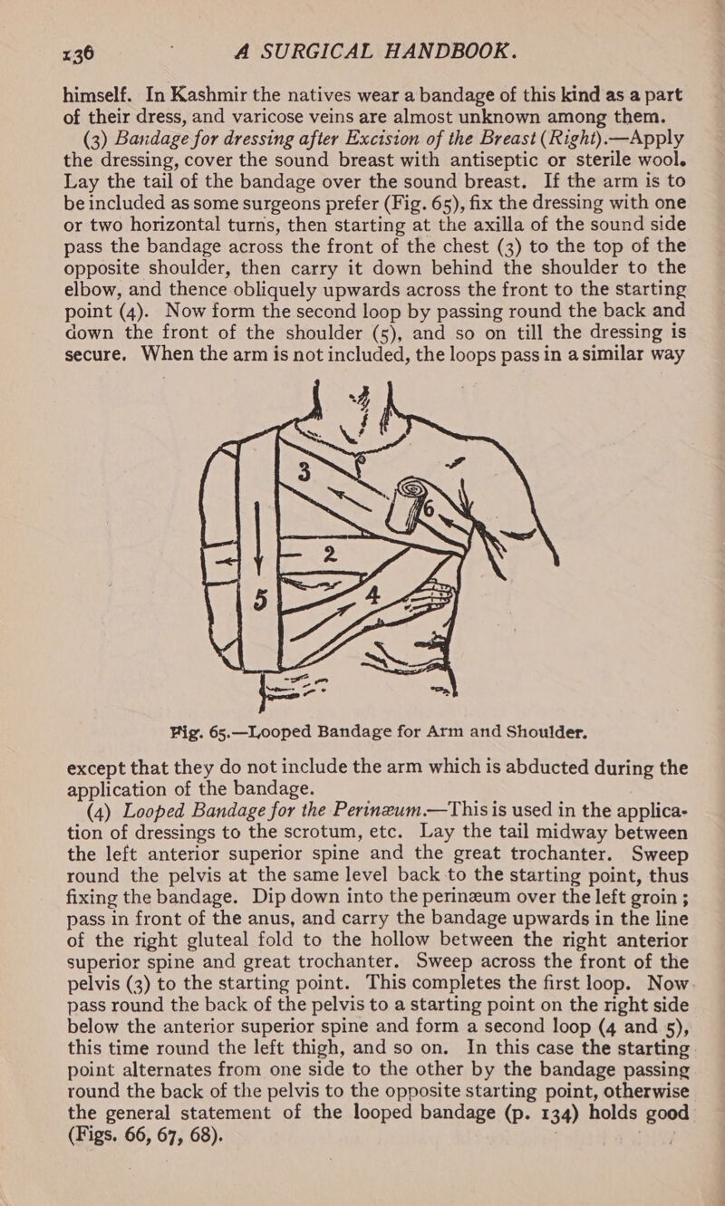 himself. In Kashmir the natives wear a bandage of this kind as a part of their dress, and varicose veins are almost unknown among them. (3) Bandage for dressing after Excision of the Breast (Right).—Apply the dressing, cover the sound breast with antiseptic or sterile wool. Lay the tail of the bandage over the sound breast. If the arm is to be included as some surgeons prefer (Fig. 65), fix the dressing with one or two horizontal turns, then starting at the axilla of the sound side pass the bandage across the front of the chest (3) to the top of the opposite shoulder, then carry it down behind the shoulder to the elbow, and thence obliquely upwards across the front to the starting point (4). Now form the second loop by passing round the back and down the front of the shoulder (5), and so on till the dressing is secure. When the arm is not included, the loops pass in a similar way Rig. 65.—Looped Bandage for Arm and Shoulder. except that they do not include the arm which is abducted during the application of the bandage. (4) Looped Bandage for the Perineum.—Thisis used in the applica- tion of dressings to the scrotum, etc. Lay the tail midway between the left anterior superior spine and the great trochanter. Sweep round the pelvis at the same level back to the starting point, thus fixing the bandage. Dip down into the perineum over the left groin ; pass in front of the anus, and carry the bandage upwards in the line of the right gluteal fold to the hollow between the right anterior superior spine and great trochanter. Sweep across the front of the pelvis (3) to the starting point. This completes the first loop. Now. pass round the back of the pelvis to a starting point on the right side below the anterior superior spine and form a second loop (4 and 5), this time round the left thigh, and so on. In this case the starting point alternates from one side to the other by the bandage passing round the back of the pelvis to the opposite starting point, otherwise the general statement of the looped bandage (p. 134) holds Reha (Figs. 66, 67, 68).