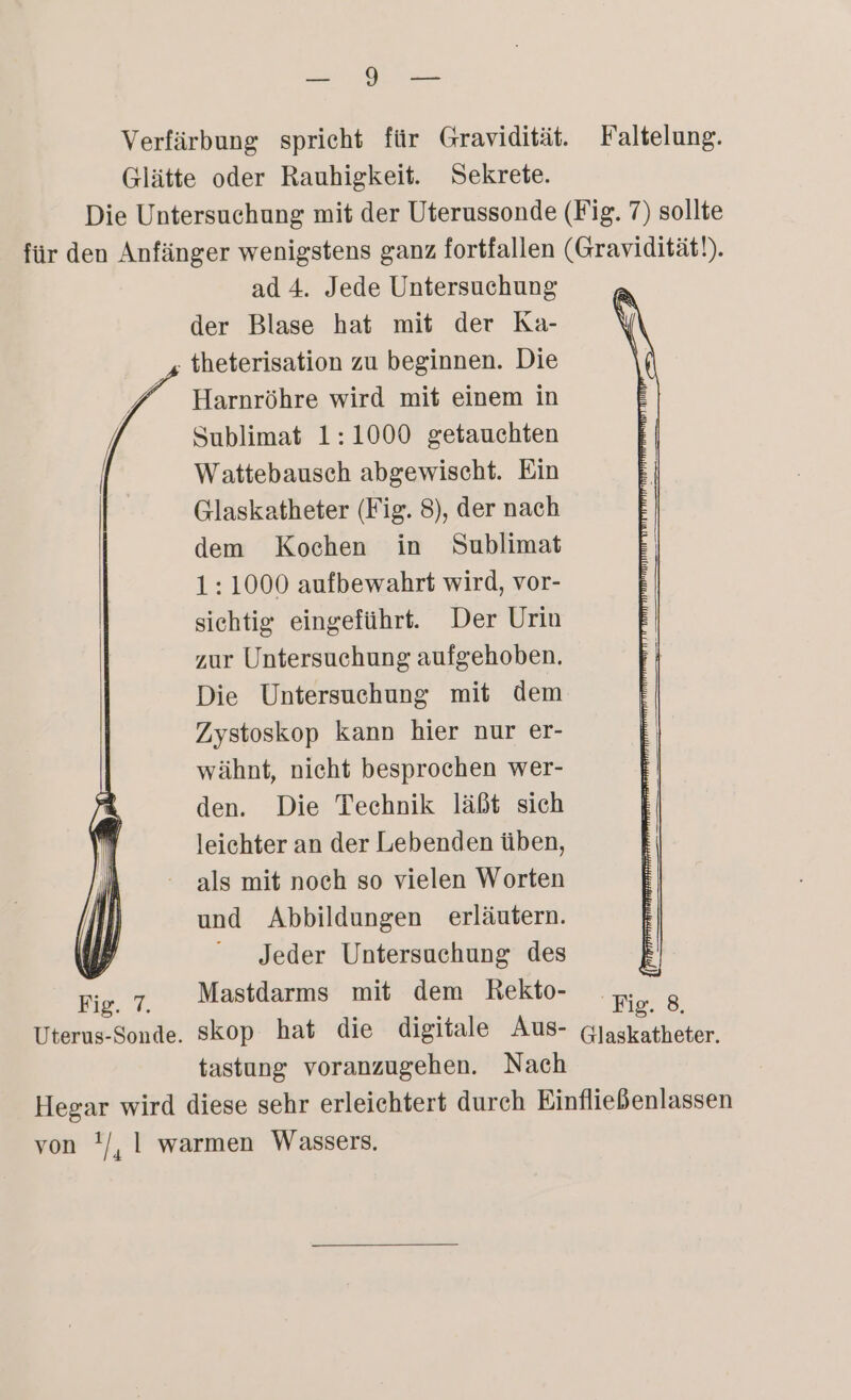 a SEE Verfärbung spricht für Gravidität. Faltelung. Glätte oder Rauhigkeit. Sekrete. Die Untersuchung mit der Uterussonde (Fig. 7) sollte für den Anfänger wenigstens ganz fortfallen (Gravidität!). ad 4. Jede Untersuchung der Blase hat mit der Ka- ; theterisation zu beginnen. Die Harnröhre wird mit einem in Sublimat 1:1000 getauchten Wattebausch abgewischt. Ein Glaskatheter (Fig. 8), der nach dem Kochen in Sublimat 1: 1000 aufbewahrt wird, vor- sichtig eingeführt. Der Urin zur Untersuchung aufgehoben. Die Untersuchung mit dem Zystoskop kann hier nur er- wähnt, nicht besprochen wer- den. Die Technik läßt sich leichter an der Lebenden üben, als mit noch so vielen Worten und Abbildungen erläutern. Jeder Untersuchung des Fig. 7. Mastdarms mit dem Rekto- Fig. 8. Uterus-Sonde. skop hat die digitale Aus- (jaskatheter. tastung voranzugehen. Nach Hegar wird diese sehr erleichtert dureh Einfließenlassen