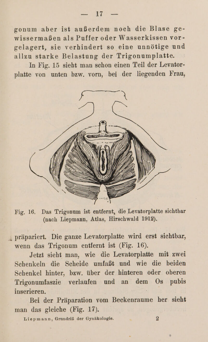 2 gonum aber ist außerdem noch die Blase ge- wissermaßen als Puffer oder Wasserkissen vor- gelagert, sie verhindert so eine unnötige und allzu starke Belastung der Trigonumplatte. In Fig. 15 sieht man schon einen Teil der Levator- platte von unten bzw. vorn, bei der liegenden Frau, Fig. 16. Das Trigonum ist entfernt, die Levatorplatte sichtbar (nach Liepmann, Atlas, Hirschwald 1912). ‚ präpariert. Die ganze Levatorplatte wird erst sichtbar, wenn das Trigonum entfernt ist (Fig. 16). Jetzt sieht man, wie die Levatorplatte mit zwei Schenkeln die Scheide umfaßt und wie die beiden Schenkel hinter, bzw. über der hinteren oder oberen Trigonumfaszie verlaufen und an dem Os pubis inserieren. | Bei der Präparation vom Beckenraume her sieht man das gleiche (Fig. 17). Liepmann, Grundriß der Gynäkologie. 2