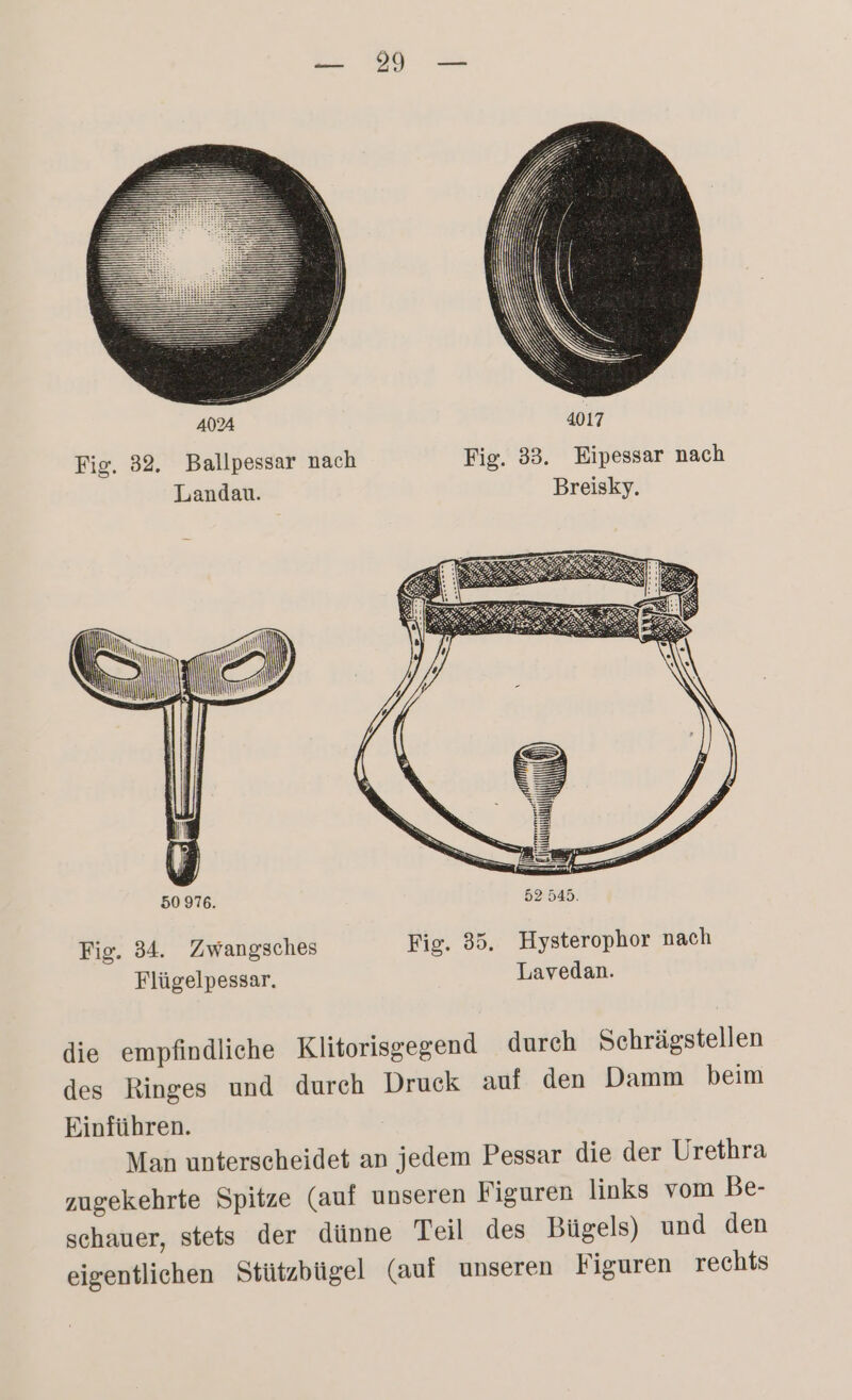 Fig. 32. Ballpessar nach Fig. 33. Eipessar nach Landau. Breisky. S ERS 67 EEE Le IH 17 > N) mW as 50 976. 52 545. Fig. 34. Zwangsches Fig. 35. Hysterophor nach Flügelpessar. Lavedan. die empfindliche Klitorisgegend durch Schrägstellen des Ringes und durch Druck auf den Damm beim Einführen. Man unterscheidet an jedem Pessar die der Urethra zugekehrte Spitze (auf unseren Figuren links vom Be- schauer, stets der dünne Teil des Bügels) und den eigentlichen Stützbügel (auf unseren Figuren rechts