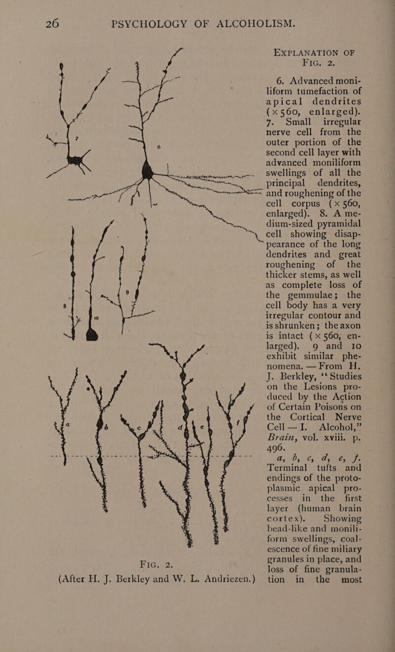 ot pi oer A oes EXPLANATION OF HhiGwi2Zs 6. Advanced moni- liform tumefaction of apical dendrites (x 560, enlarged). 7. Small irregular nerve cell from the outer portion of the second cell layer with advanced moniliform swellings of all the principal dendrites, and roughening of the cell corpus (x 560, enlarged). 8. A me- dium-sized pyramidal cell showing disap- pearance of the long dendrites and great roughening of the thicker stems, as well as complete loss of the gemmulae; the cell body has a very irregular contour and is shrunken; theaxon is intact (x 560, en- larged). 9 and 10 exhibit similar phe- nomena. — From H. J. Berkley, ‘* Studies on the Lesions pro- duced by the Action of Certain Poisons on the Cortical Nerve Cell—I. Alcohol,” Brain, vol. xviil. p. 496. 0, 0, ity elem Terminal tufts and endings of the proto- plasmic apical pro- cesses in the first layer (human brain cortex). Showing bead-like and monili- form swellings, coal- escence of fine miliary granules in place, and loss of fine granula- tion in the most