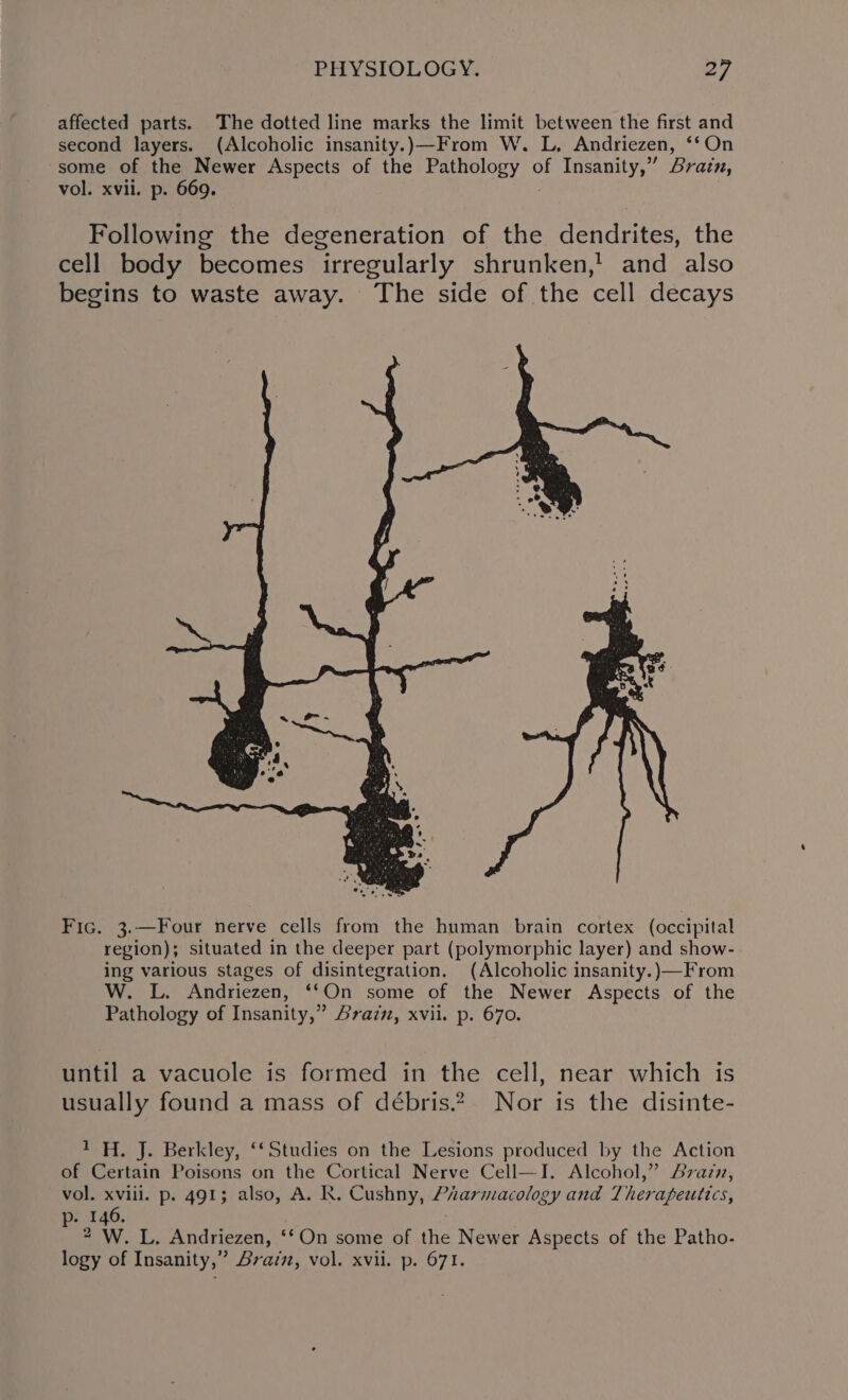 affected parts. The dotted line marks the limit between the first and second layers. (Alcoholic insanity.)—From W. L. Andriezen, ‘‘On some of the Newer Aspects of the Pathology of Insanity,” Brain, vol. xvii. p. 669. Following the degeneration of the dendrites, the cell body becomes irregularly shrunken,' and also begins to waste away. The side of the cell decays Fic. 3.—Four nerve cells from the human brain cortex (occipital region); situated in the deeper part (polymorphic layer) and show- ing various stages of disintegration. (Alcoholic insanity.)—From W. L. Andriezen, ‘‘On some of the Newer Aspects of the Pathology of Insanity,” razz, xvii. p. 670. until a vacuole is formed in the cell, near which is usually found a mass of débris.2.— Nor is the disinte- 1H. J. Berkley, ‘‘Studies on the Lesions produced by the Action of Certain Poisons on the Cortical Nerve Cell—I. Alcohol,” Avazzz, vol. xviii. p. 491; also, A. R. Cushny, Piarmacology and Therapeutics, p- 146. 2 W. L. Andriezen, ‘‘On some of the Newer Aspects of the Patho-