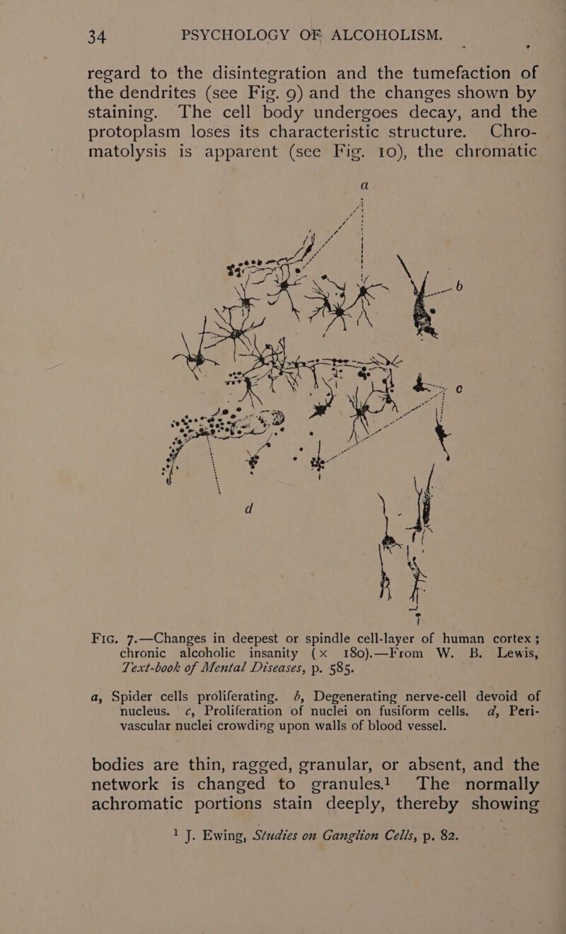 regard to the disintegration and the tumefaction of the dendrites (see Fig. 9) and the changes shown by staining. The cell body undergoes decay, and the protoplasm loses its characteristic structure. Chro- matolysis is apparent (see Fig. 10), the chromatic Fic. 7.—Changes in deepest or spindle cell-layer of human cortex ; chronic alcoholic insanity (x 180).—From W. B. Lewis, Text-book of Mental Diseases, p. 585. a, Spider cells proliferating. 6, Degenerating nerve-cell devoid of nucleus. ¢, Proliferation of nuclei on fusiform cells. ad, Peri- vascular nuclei crowding upon walls of blood vessel. bodies are thin, ragged, granular, or absent, and the network is changed to granules! The normally achromatic portions stain deeply, thereby showing 1 J. Ewing, Studies on Ganglion Cells, p. 82.