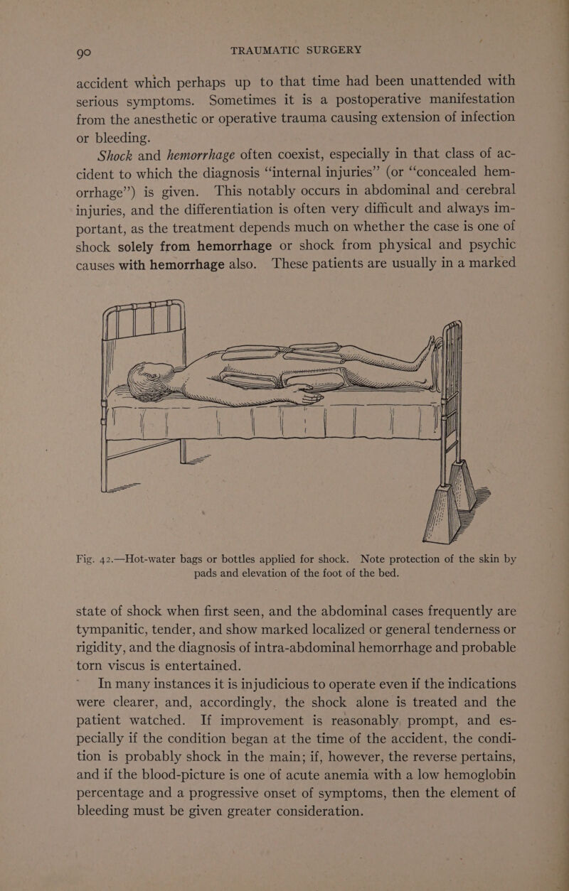accident which perhaps up to that time had been unattended with serious symptoms. Sometimes it is a postoperative manifestation from the anesthetic or operative trauma causing extension of infection or bleeding. Shock and hemorrhage often coexist, especially in that class of ac- cident to which the diagnosis “internal injuries” (or ‘concealed hem- orrhage”) is given. This notably occurs in abdominal and cerebral injuries, and the differentiation is often very difficult and always im- portant, as the treatment depends much on whether the case is one of shock solely from hemorrhage or shock from physical and psychic causes with hemorrhage also. These patients are usually in a marked qumel | eee ae | = i_— ] | Fig. 42,—Hot-water bags or bottles applied for shock. Note protection of the skin by pads and elevation of the foot of the bed. state of shock when first seen, and the abdominal cases frequently are tympanitic, tender, and show marked localized or general tenderness or rigidity, and the diagnosis of intra-abdominal hemorrhage and probable torn viscus is entertained. In many instances it is injudicious to operate even if the indications were clearer, and, accordingly, the shock alone is treated and the patient watched. If improvement is reasonably prompt, and es- pecially if the condition began at the time of the accident, the condi- tion is probably shock in the main; if, however, the reverse pertains, and if the blood-picture is one of acute anemia with a low hemoglobin percentage and a progressive onset of symptoms, then the element of bleeding must be given greater consideration.