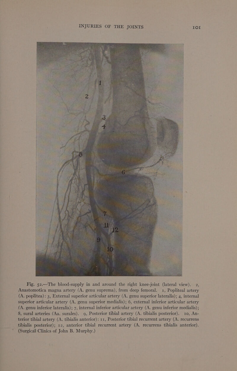 Fig. 52.—The blood-supply in and around the right knee-joint (lateral view). 2, Anastomotica magna artery (A. genu suprema), from deep femoral. 1, Popliteal artery (A. poplitea): 3, External superior articular artery (A. genu superior lateralis); 4, internal superior articular artery (A. genu superior medialis); 6, external inferior articular artery (A. genu inferior lateralis); 7, internal inferior articular artery (A. genu inferior medialis) ; 8, sural arteries (Aa. surales). 0, Posterior tibial artery (A. tibialis posterior). 10, An- terior tibial artery (A. tibialis anterior): 11, Posterior tibial recurrent artery (A. recurrens tibialis posterior); 12, anterior tibial recurrent artery (A. recurrens tibialis anterior).