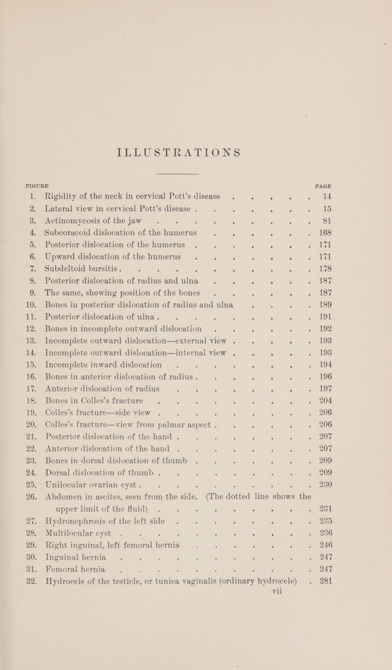 LELUSTRATIONS FIGURE PAGE 1. Rigidity of the neck in cervical Pott’s disease. ‘ : : . +214 2. Lateral view in cervical Pott’s disease . : ‘ 5 : ° . 15 3. <Actinomycosis of thejaw . : : : : ; ‘ : ~ OL 4, Subcoracoid dislocation of the humerus : : : : : . 168 5. Posterior dislocation of the humerus . ; : 5 ; : Peri 7k 6. Upward dislocation of the humerus . : ° : ° : eames 7. Subdeltoid bursitis. ‘ ‘ 5 ; , 3 : : : - 1 8. Posterior dislocation of radius and ulna : é ° : a 187 9. The same, showing position of the bones. ; : ° ° « 183 10. Bones in posterior dislocation of radius and ulna : ‘ : = 1e9 11. Posterior dislocation of ulna. ; : ‘ F : : : eal 12. Bones in incomplete outward dislocation . : : : : .- 192 13. Incomplete outward dislocation—external view . ‘ . ° . 198 14. Incomplete outward dislocation—internal view . ° ° ° » “199 15. Incomplete inward dislocation . : 5 : : ° : . 194 16. Bones in anterior dislocation of radius . : ‘ : 5 : 86 17. Anterior dislocation of radius : : : : 5 : : aly 18. Bones in Colles’s fracture ‘ ‘ . ‘ ; : : . 204 19. Colles’s fracture—side view . , : : : ; ; 5 . 206 20. Colles’s fracture—view from palmar aspect . 3 : ° . . 206 21. Posterior dislocation of the hand . : : : ‘ ; : ~~ 207 22. Anterior dislocation of the hand . : : : : : : UE 23. Bones in dorsal dislocation of thumb . : : . ; , . 209 24. Dorsal dislocation of thumb . ; : é é ; ‘ ; » 209 25. Unilocular ovarian cyst . : , : ; : ; . 230 26. Abdomen in ascites, seen from the side. (The dotted line shows the upper limit of the fluid) . ; : ‘ : ; : : «on 27. Hydronephrosis of the left side . ‘ : . . é : » 289 28. Multilocular cyst . ; : ; : : é : : : > 200 29. Right inguinal, left femoral hernia : : : 5 4 : . 246 30. Inguinal hernia . ‘ i ‘ : , ; : ; : . 247 31. Femoral hernia . : : : : : ; : : ; . 247 32. Hydrocele of the testicle, or tunica vaginalis (ordinary hydrocele) . 281 Val